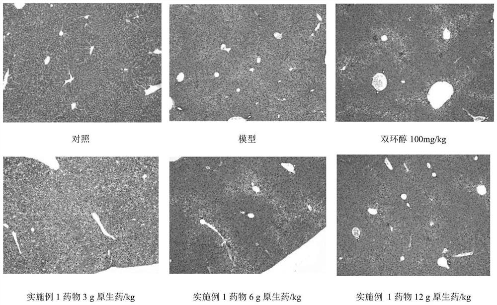 Pharmaceutical composition for preventing and treating liver injury and/or liver cancer as well as preparation method and application thereof