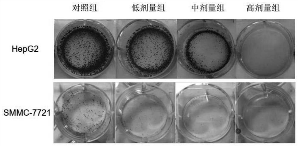 Pharmaceutical composition for preventing and treating liver injury and/or liver cancer as well as preparation method and application thereof