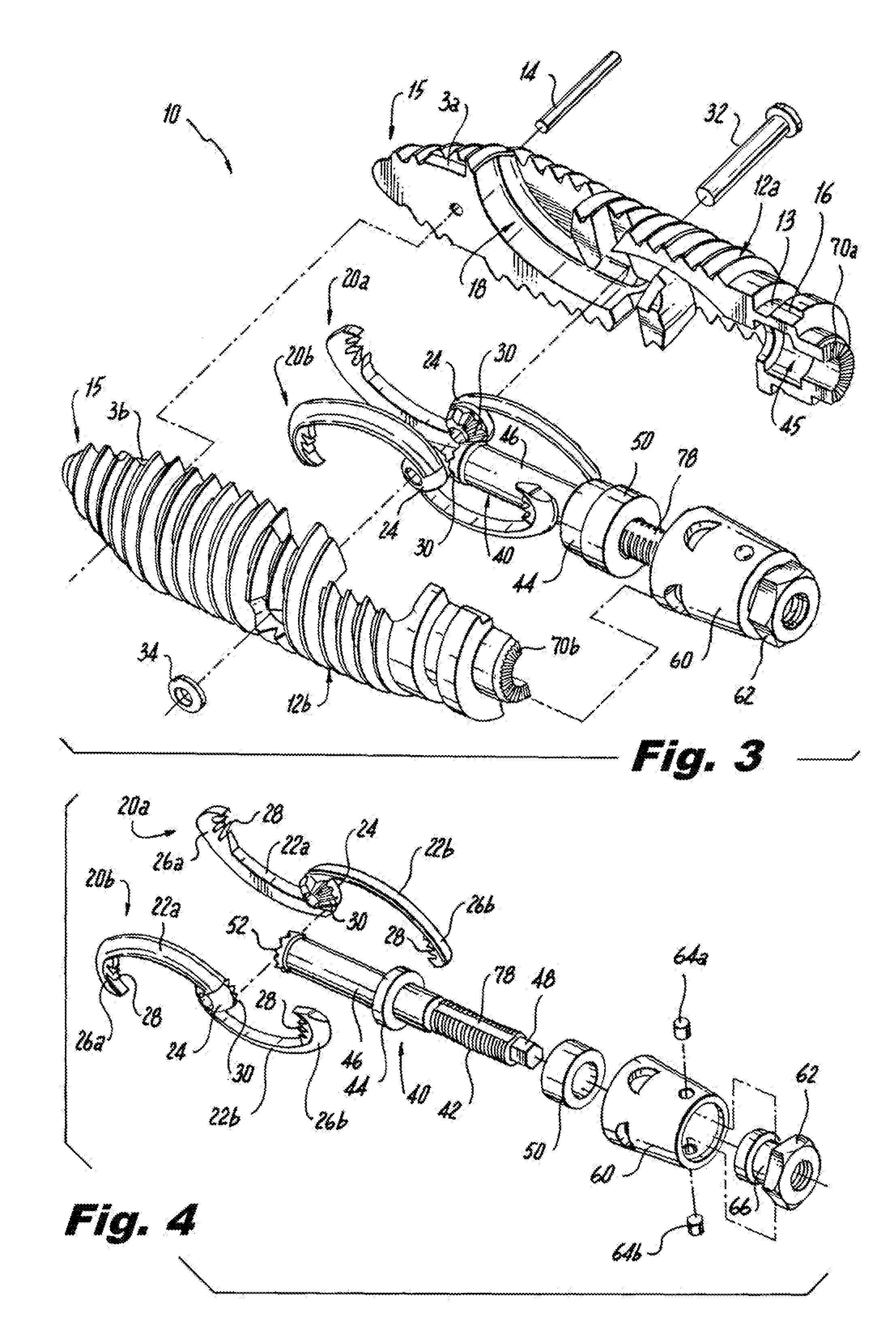 Interspinous process implants having deployable engagement arms