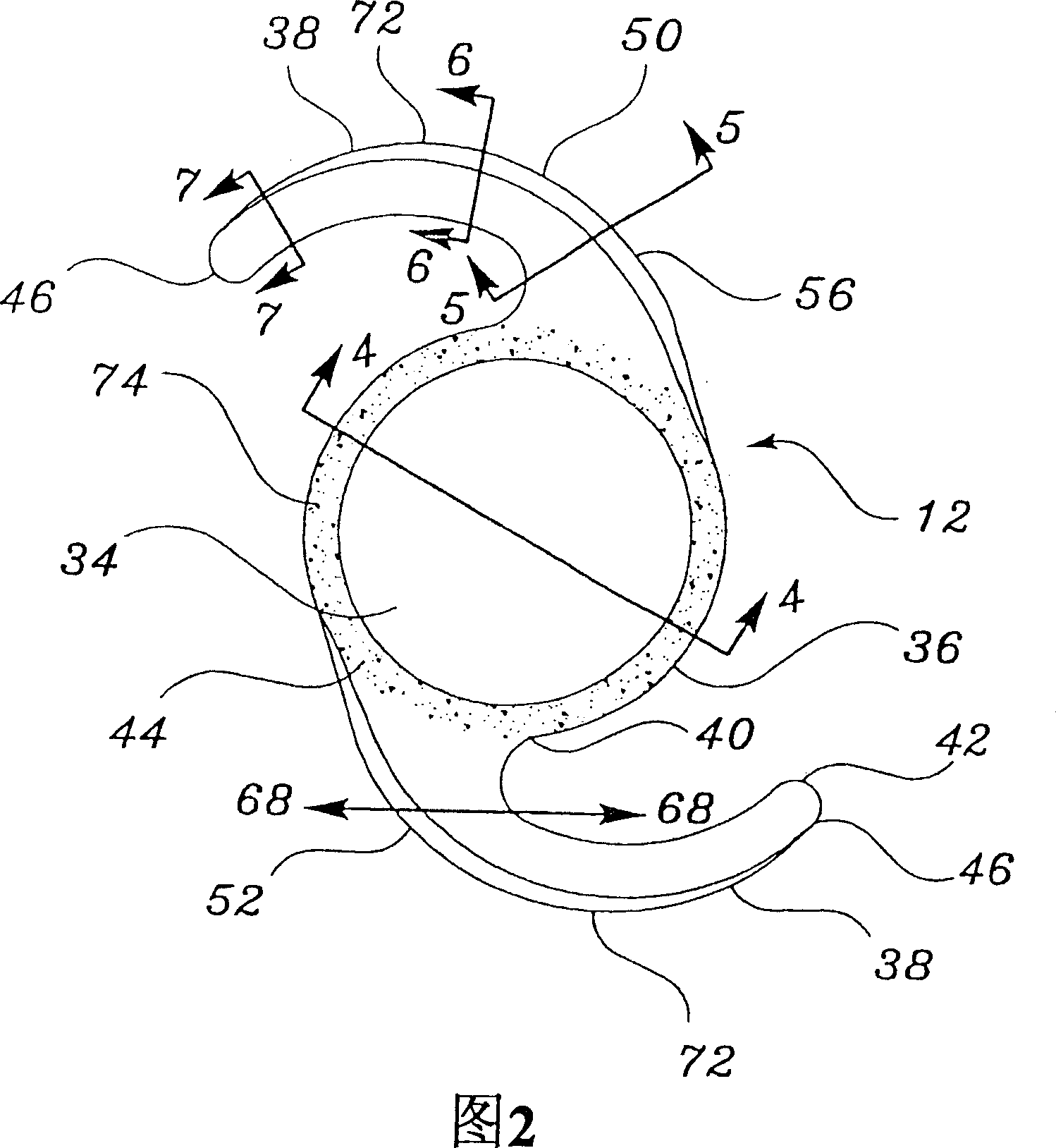 Intraocular lenses provided with angled edges to prevent posterior capsular opacification