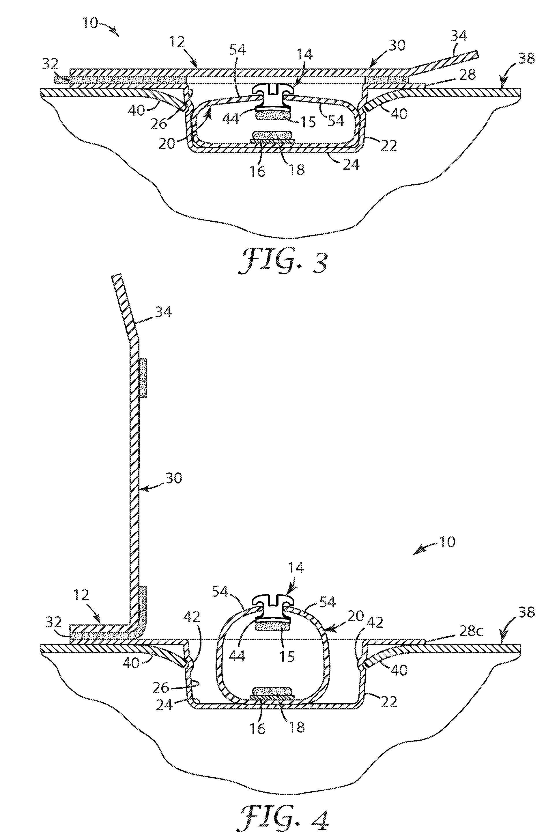 Packaged orthodontic appliance and adhesive material