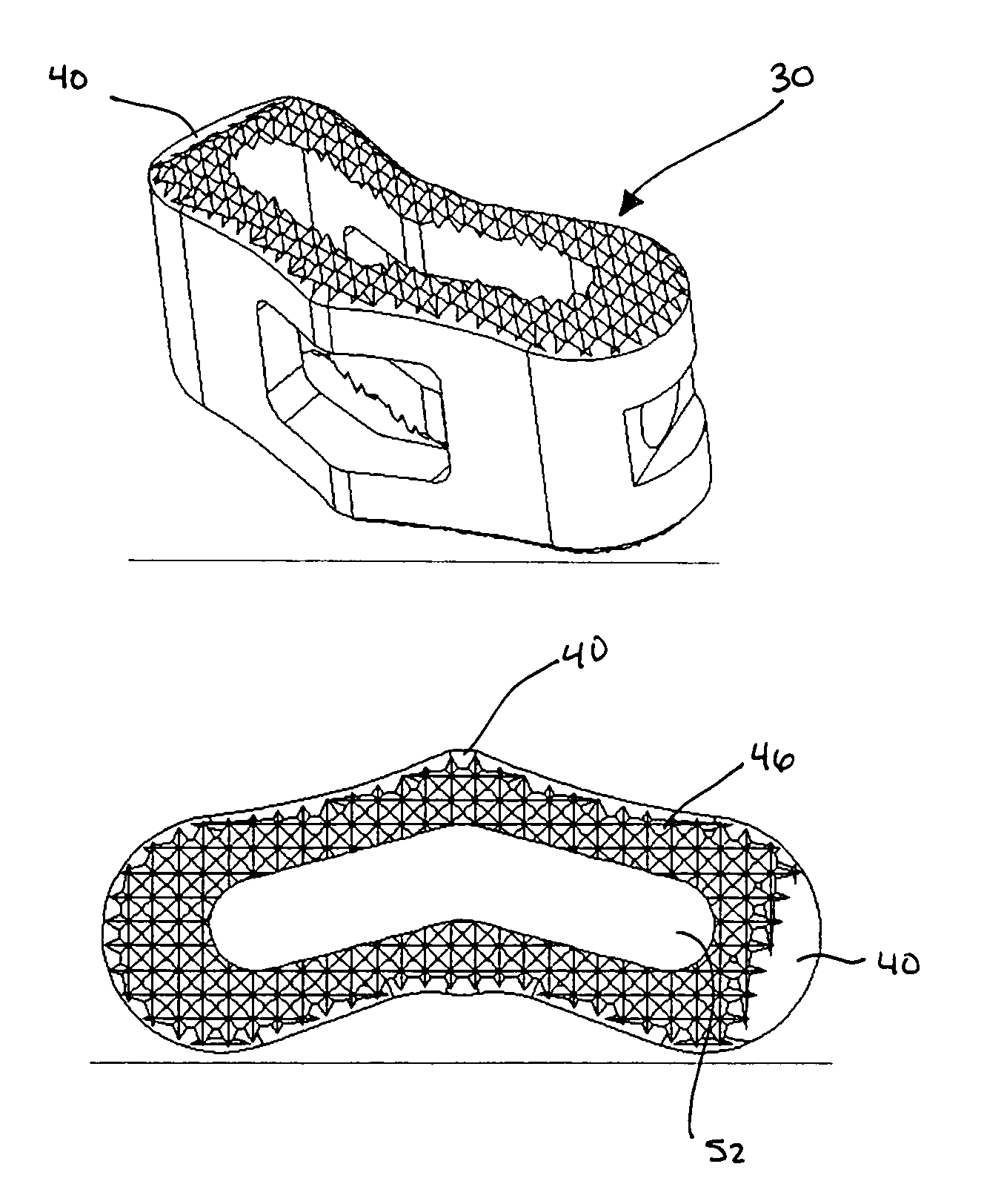 Spinal fusion implant