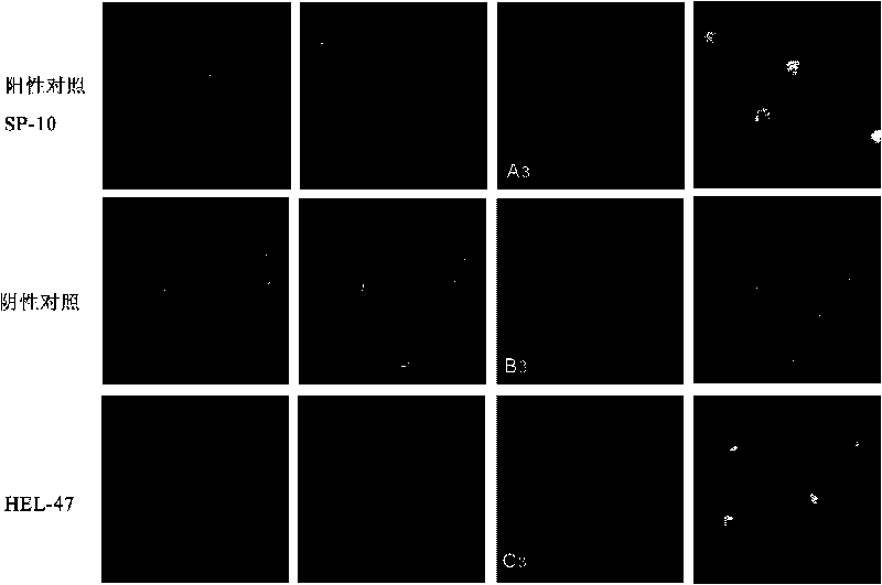 Human epididymal expression sperm binding protein HEL-47 as well as encoding gene and application thereof