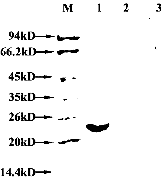 Human epididymal expression sperm binding protein HEL-47 as well as encoding gene and application thereof