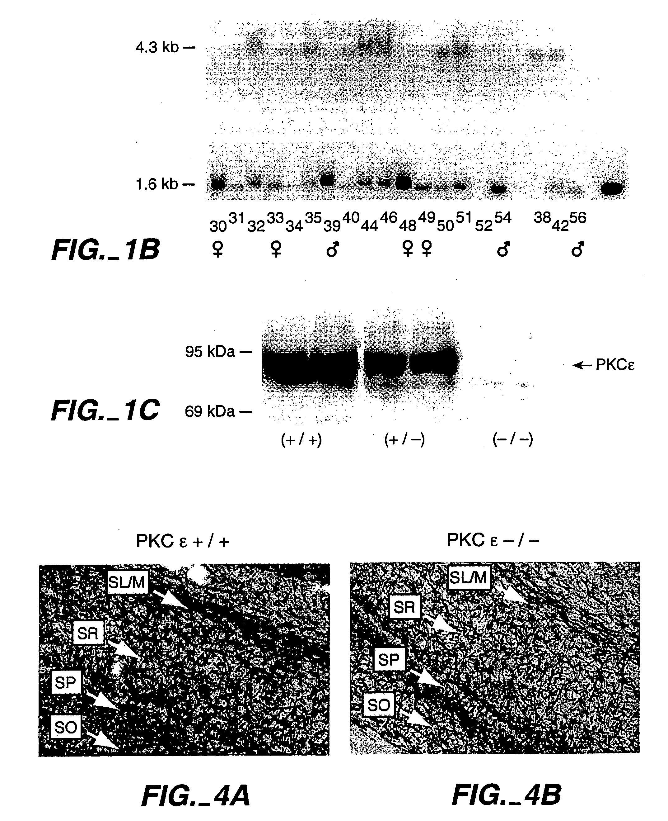 Protein kinase C epsilon as modulator of anxiety, alcohol consumption and self-administration of drugs of abuse