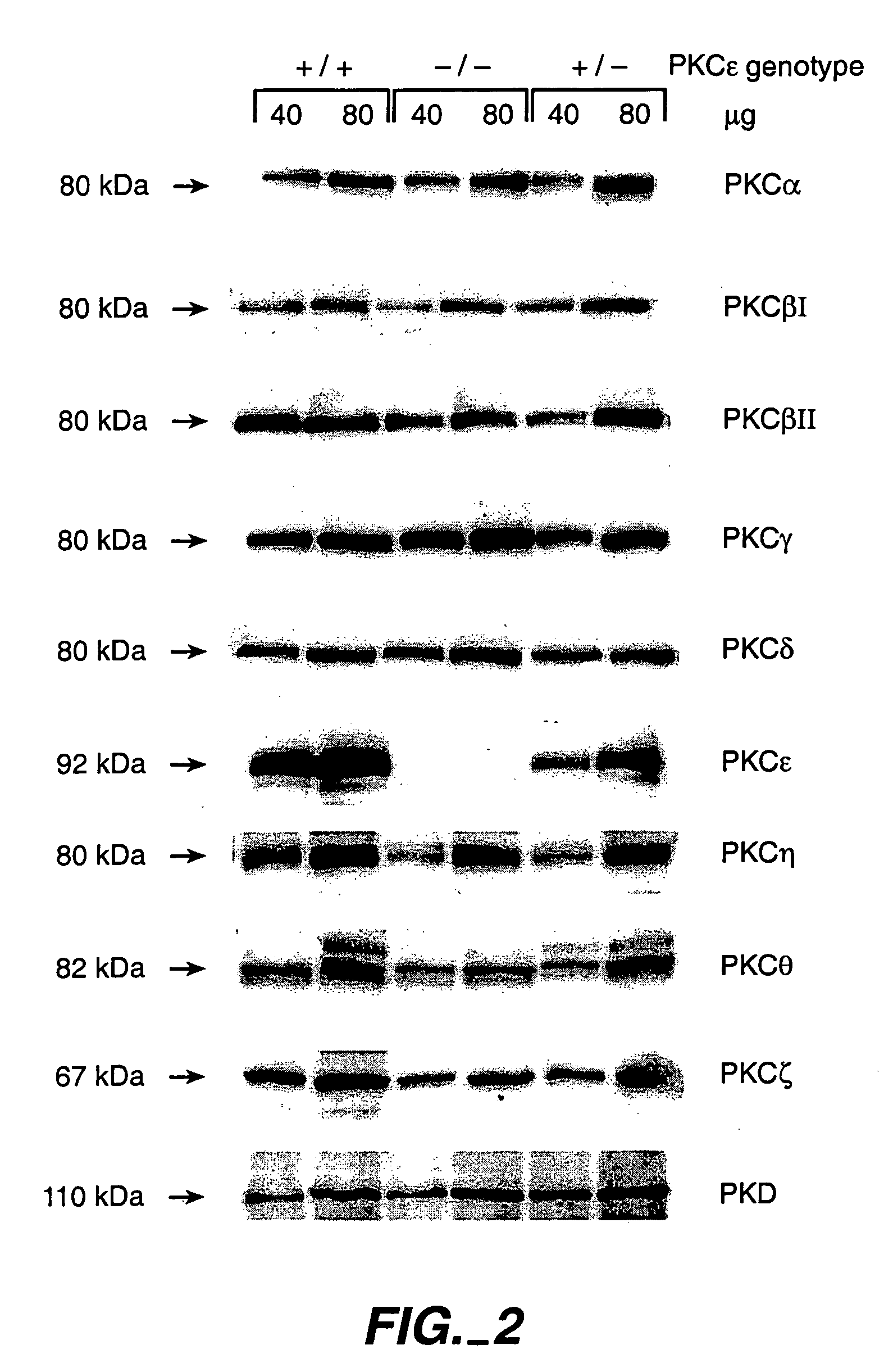 Protein kinase C epsilon as modulator of anxiety, alcohol consumption and self-administration of drugs of abuse