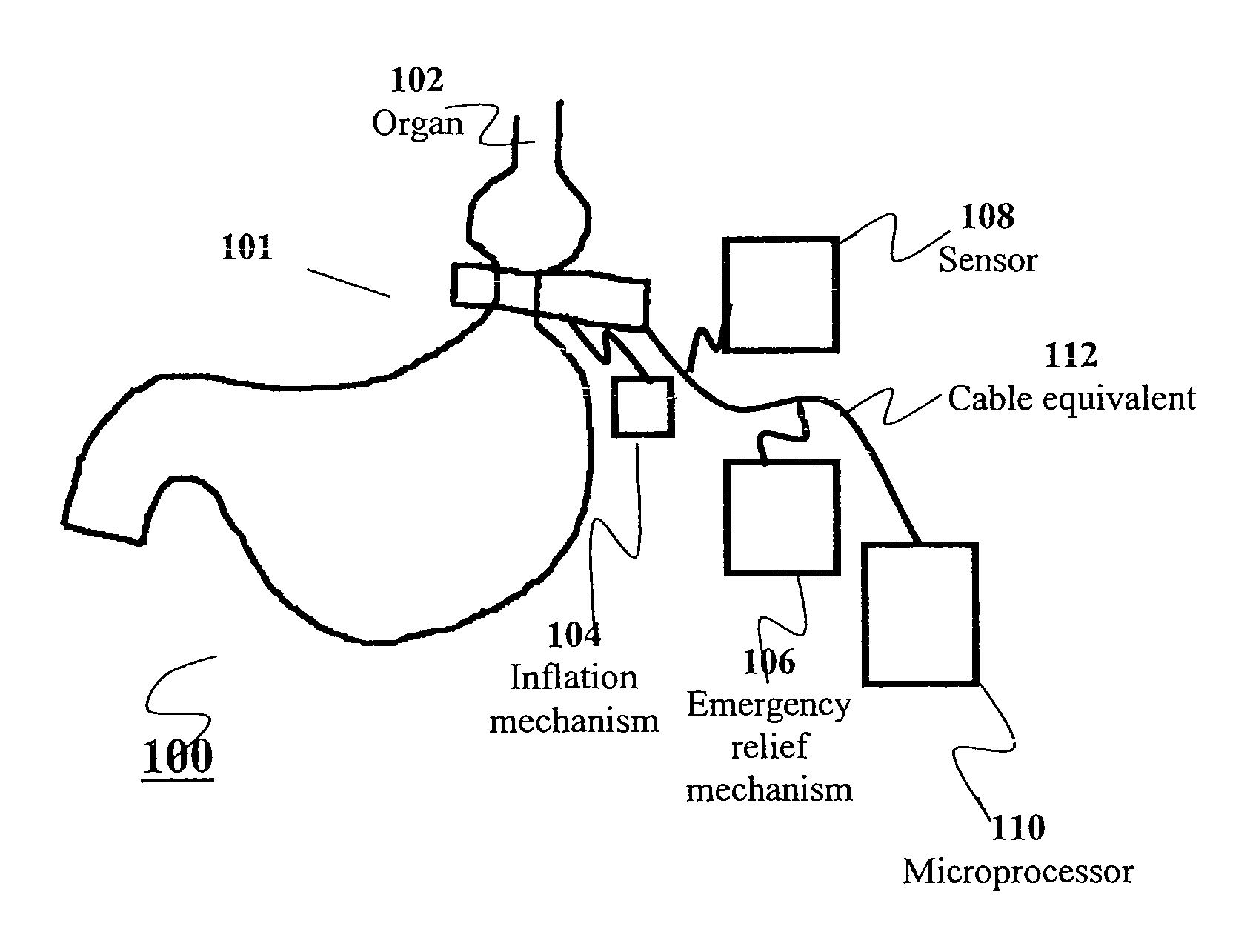 Apparatus and methods for corrective guidance of eating behavior after weight loss surgery