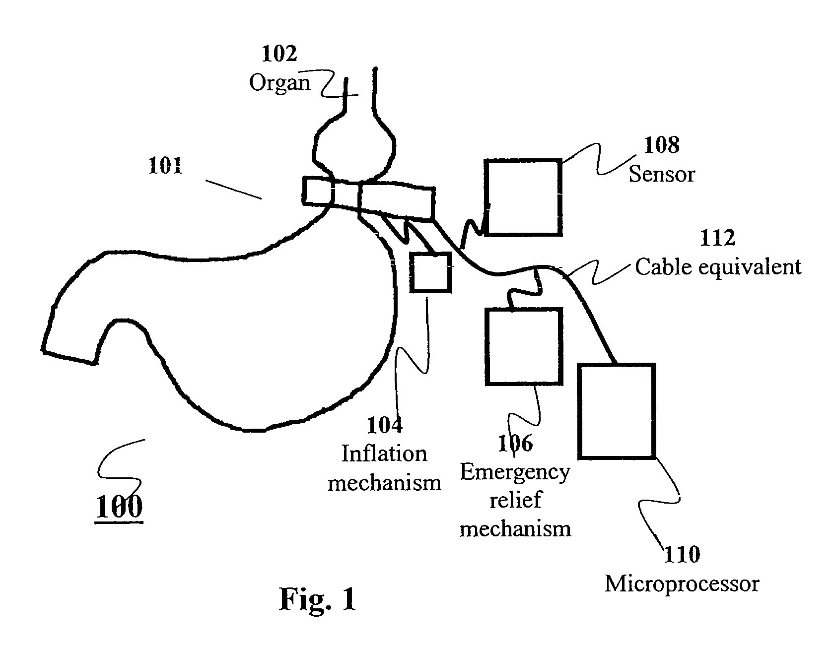 Apparatus and methods for corrective guidance of eating behavior after weight loss surgery