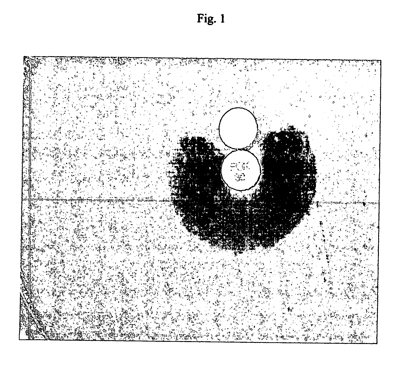 Device and method for detecting antibiotic-inactivating enzymes