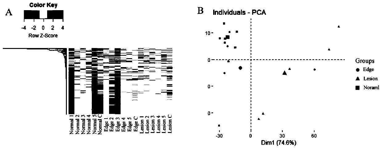 Early diagnosis and treatment biomarker for alveolar echinococcosis and application thereof