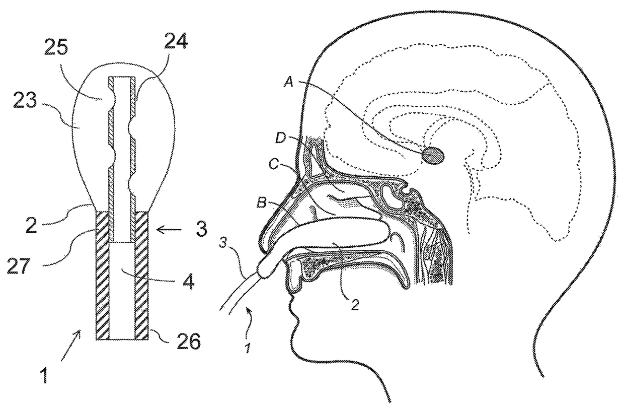 Stimulation of hypothalamus