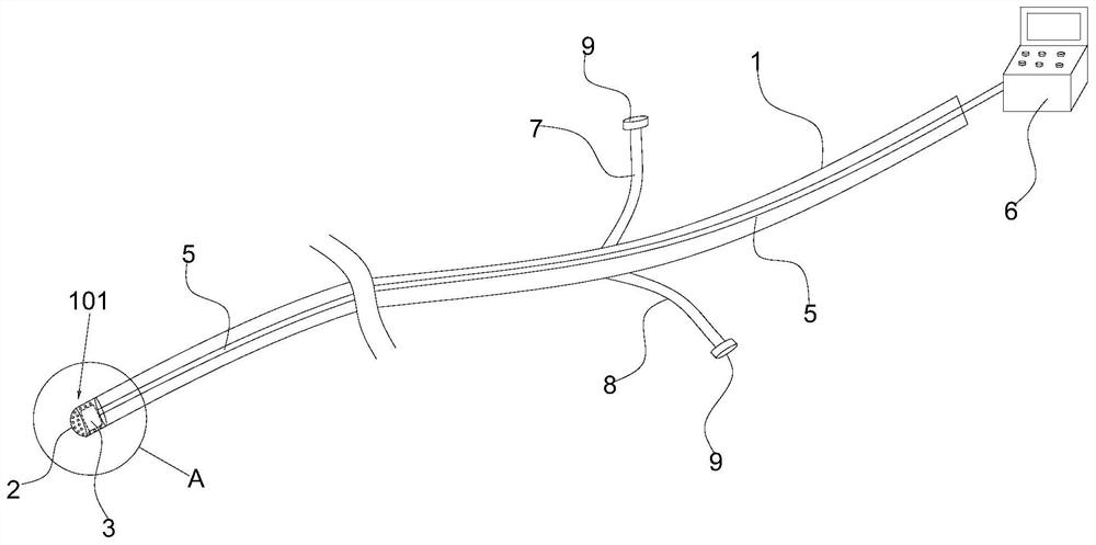 Novel stomach jejunal tube device