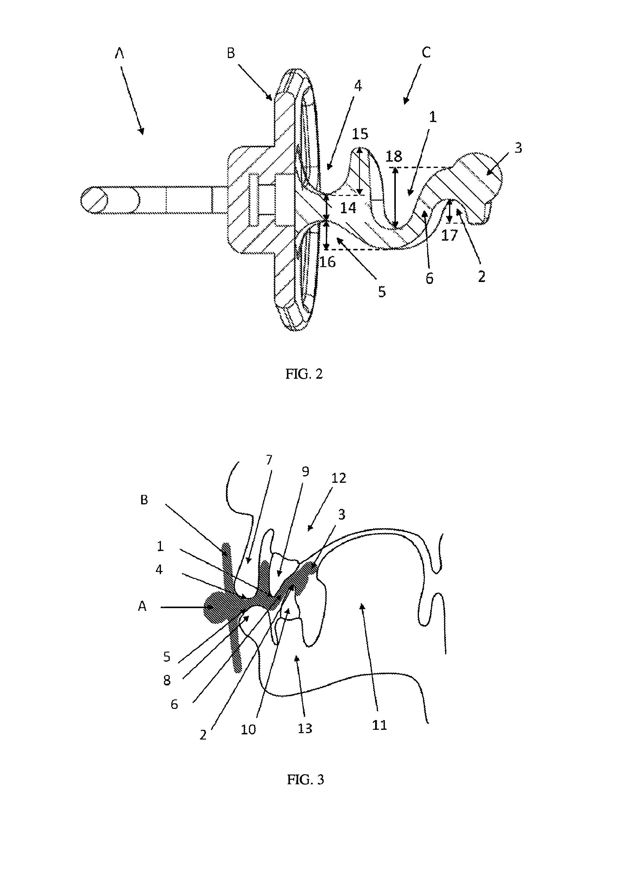 Orthodontic Comforter