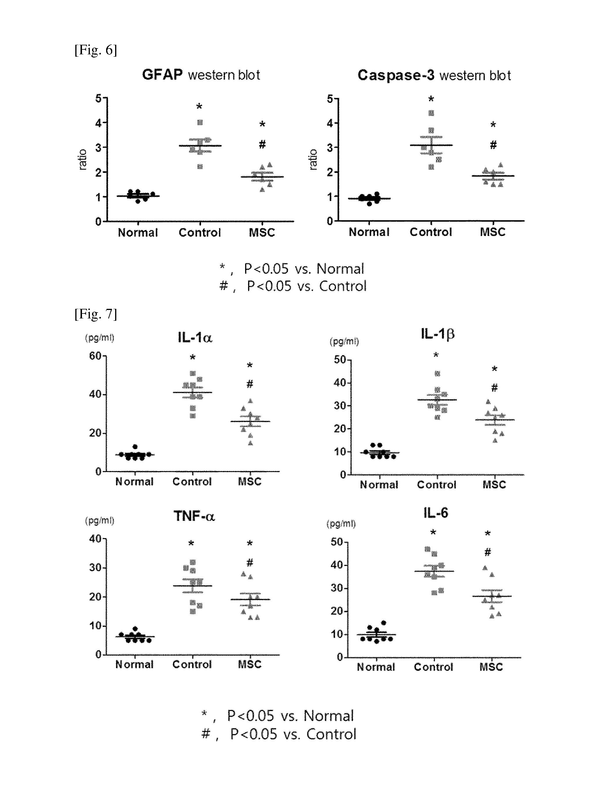 Composition for treating inflammatory brain diseases which includes stem cell as active ingredient