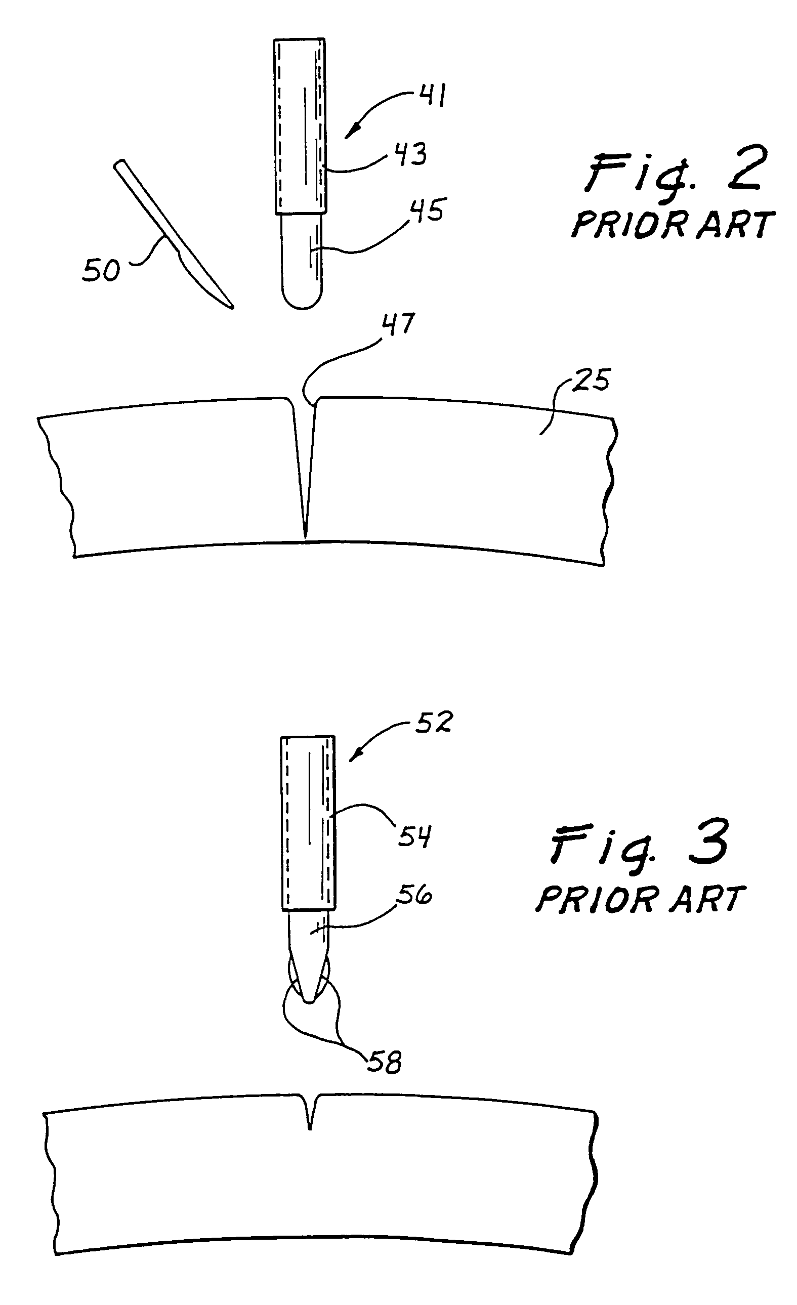 Traction trocar apparatus and method