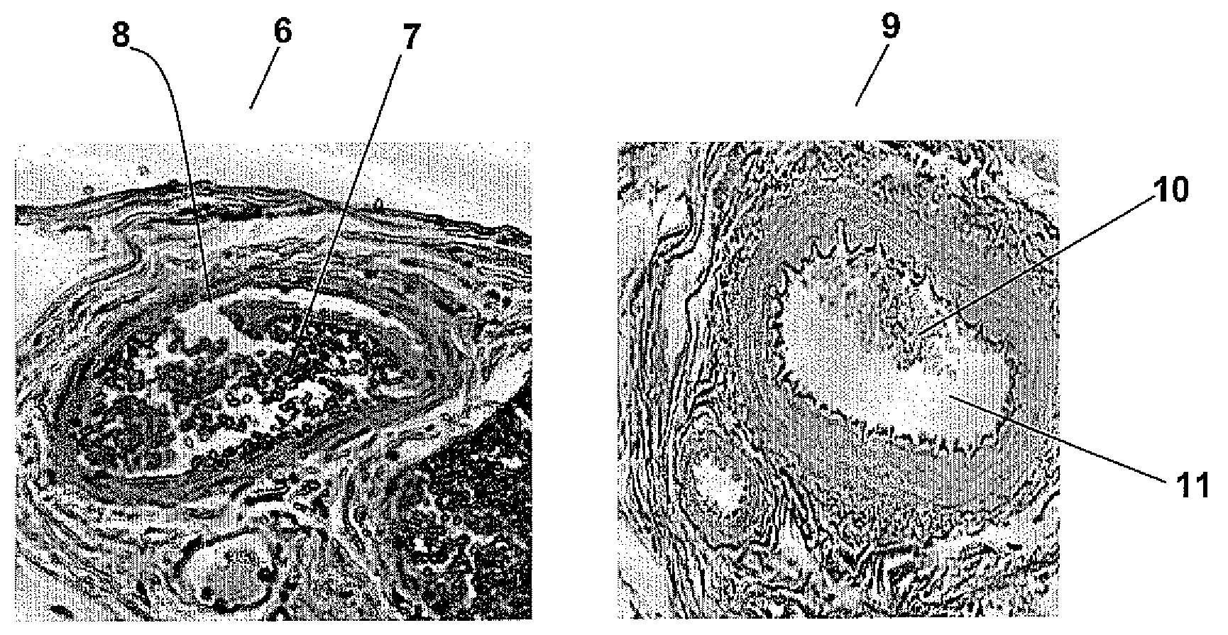 Decellularized omentum matrix and uses thereof