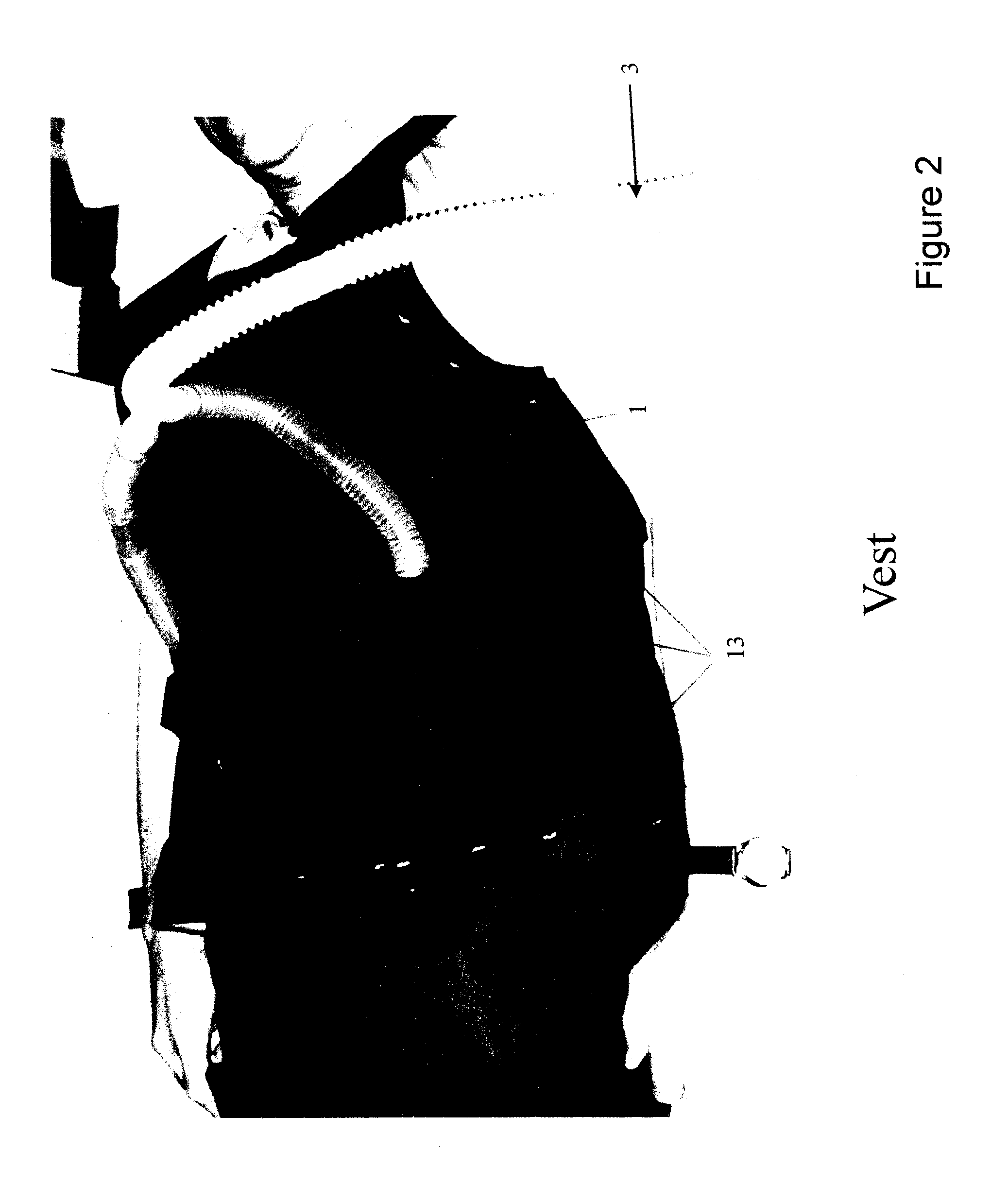 Method and device(s) for diagnosis and/or treatment of sleep apnea and related disorders