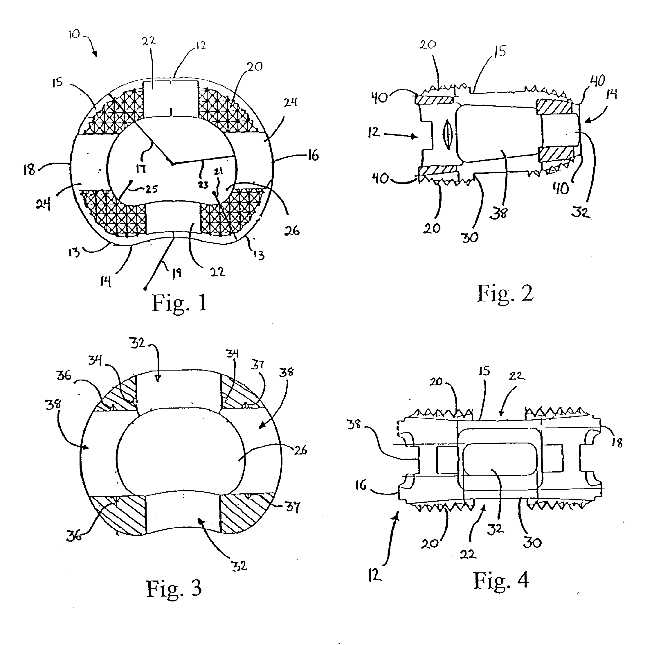 Intervertebral Implant