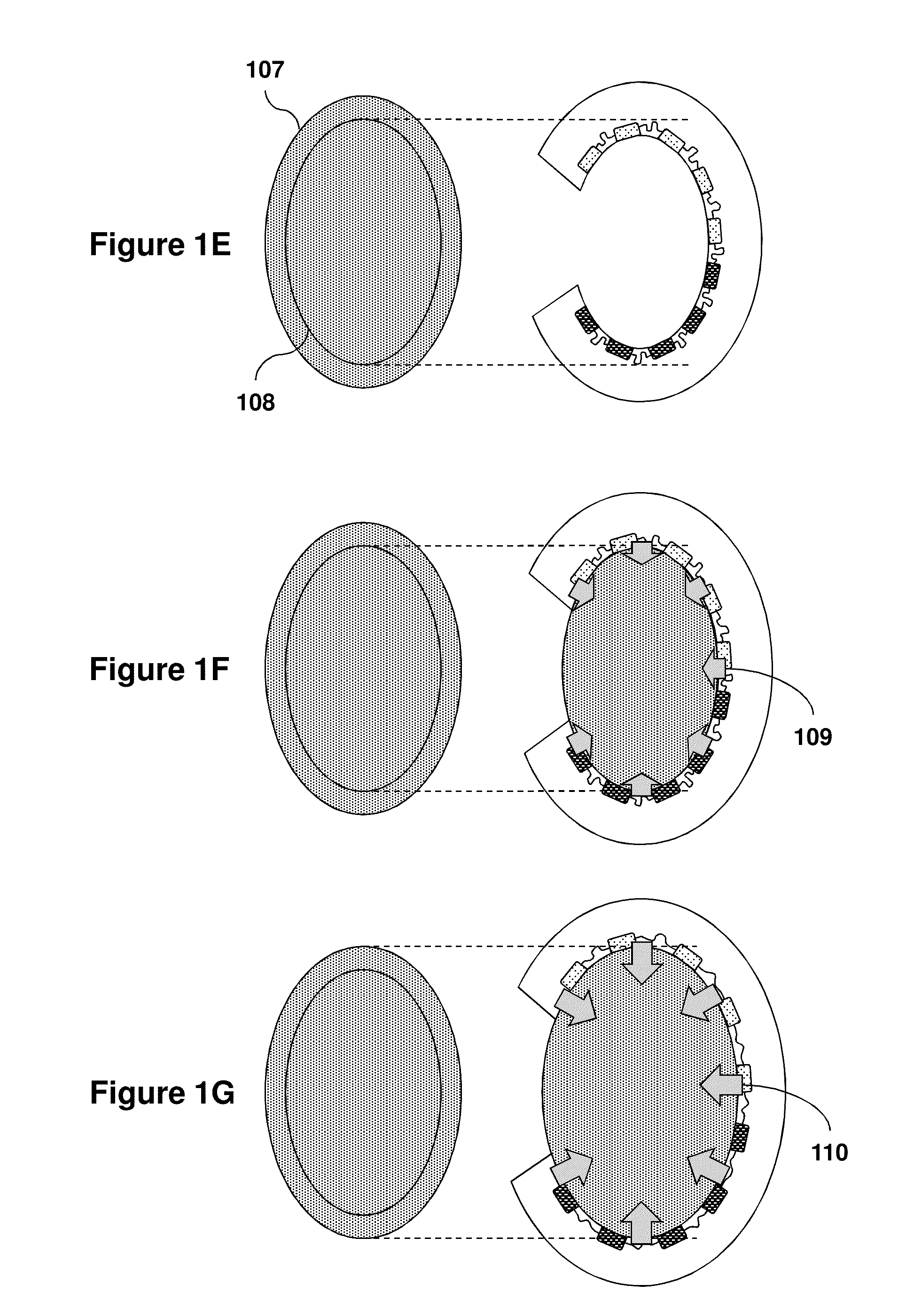 Organ Mounted Electronics