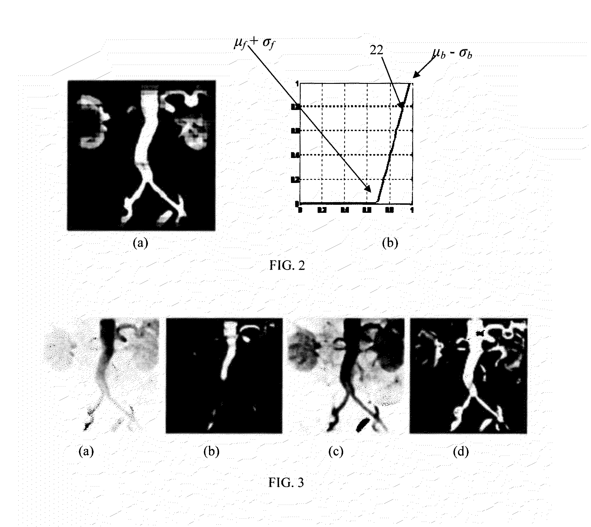 Automatic pose initialization for accurate 2-D/3-D registration applied to abdominal aortic aneurysm endovascular repair