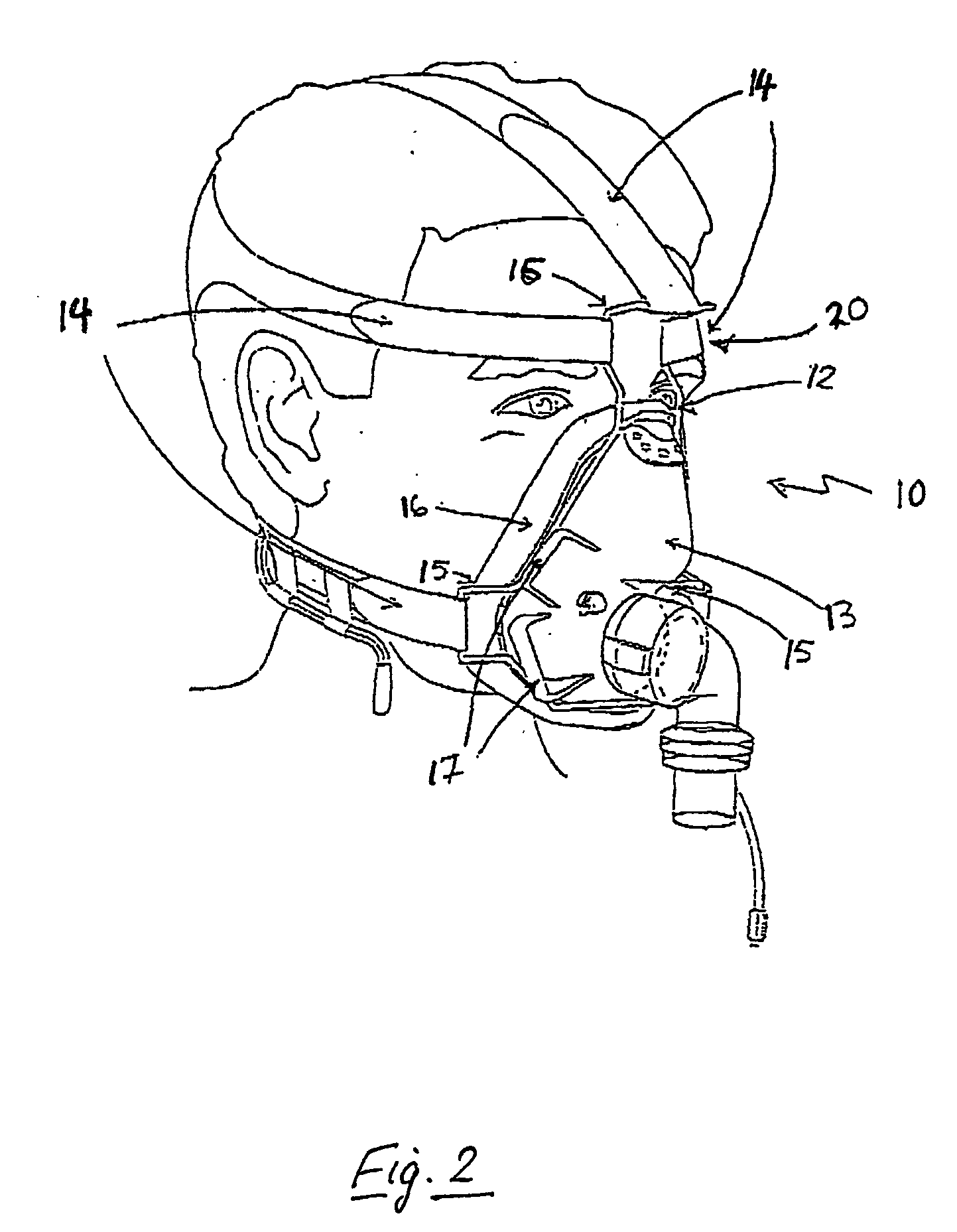 Mask brace and mask assembly