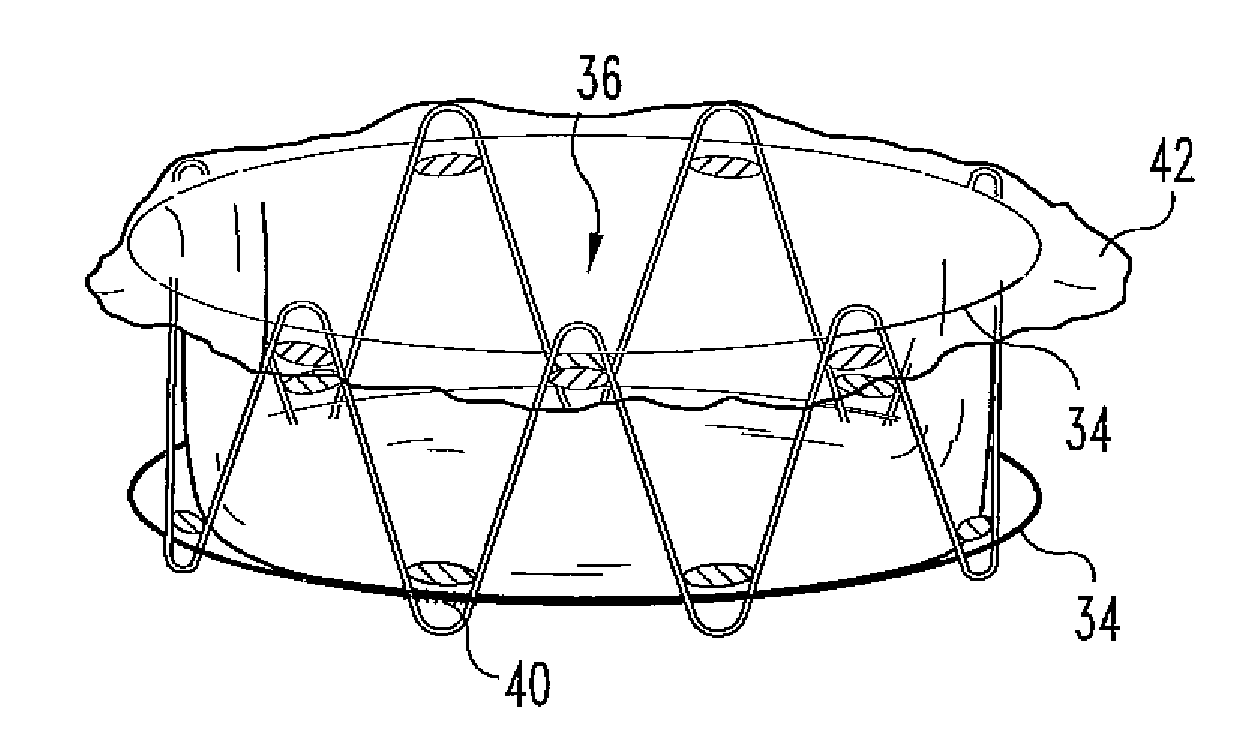 Percutaneous heart valve devices