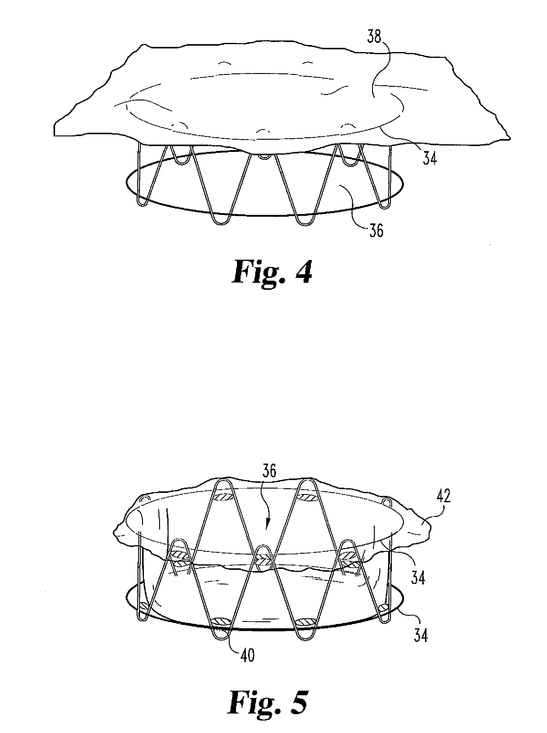 Percutaneous heart valve devices