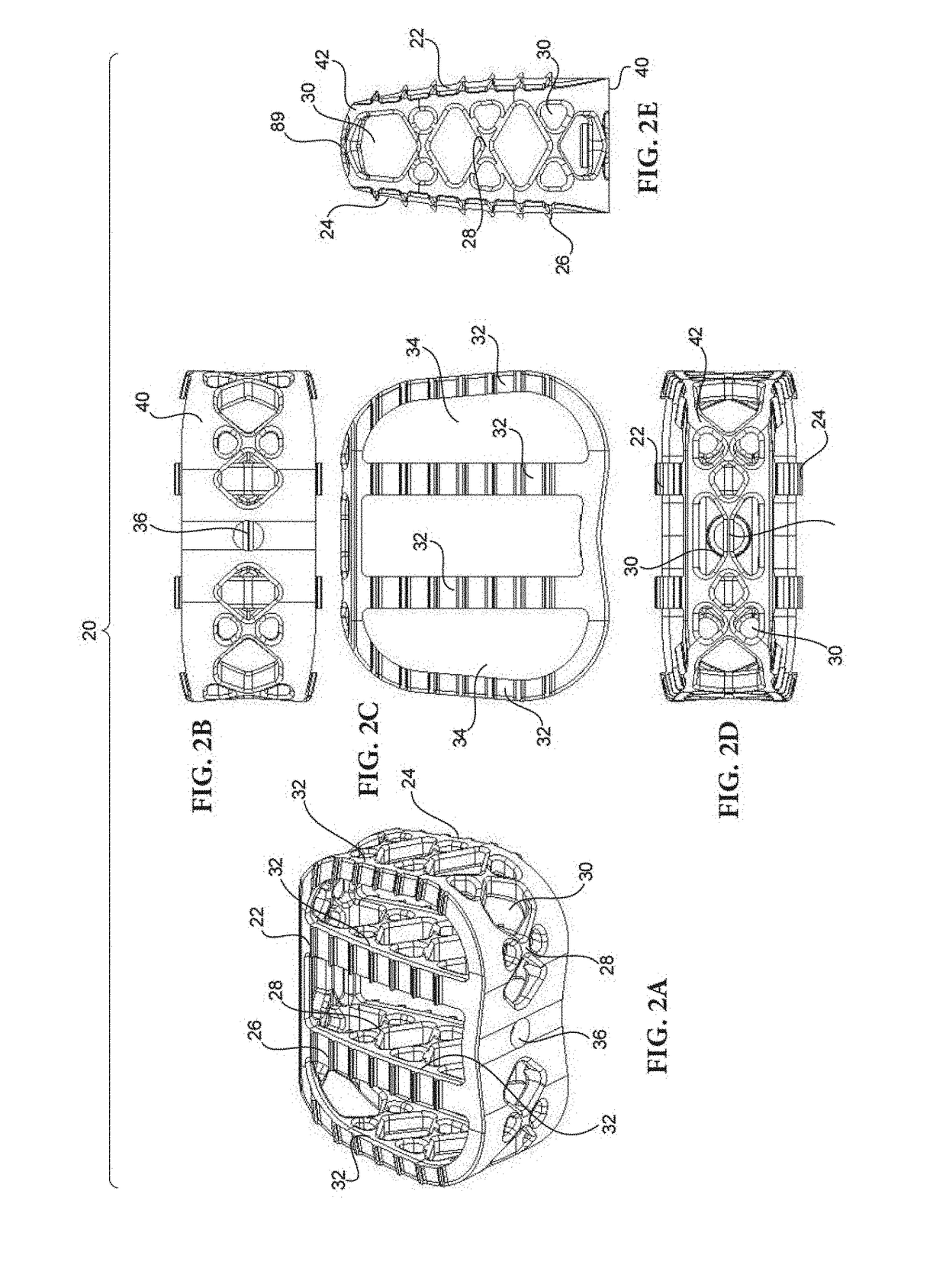 Partially resorbable implants and methods