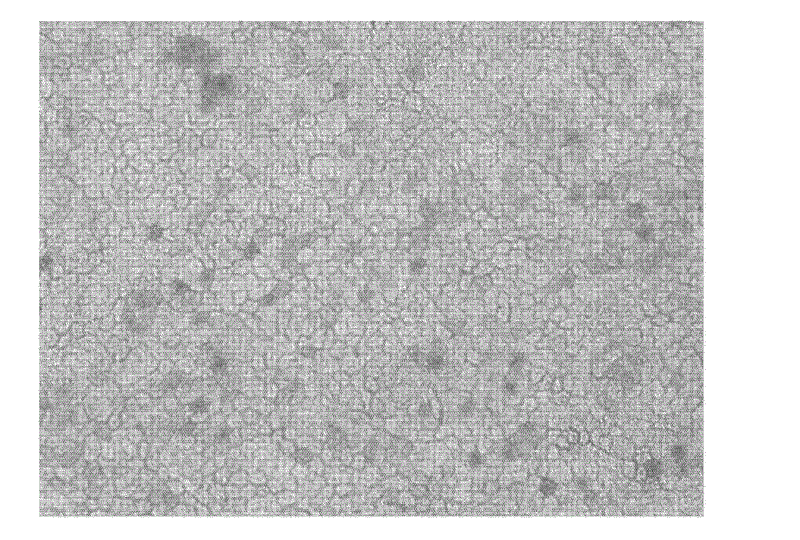 Composite anti-freezing liquid, and method for preserving human amnion by using same