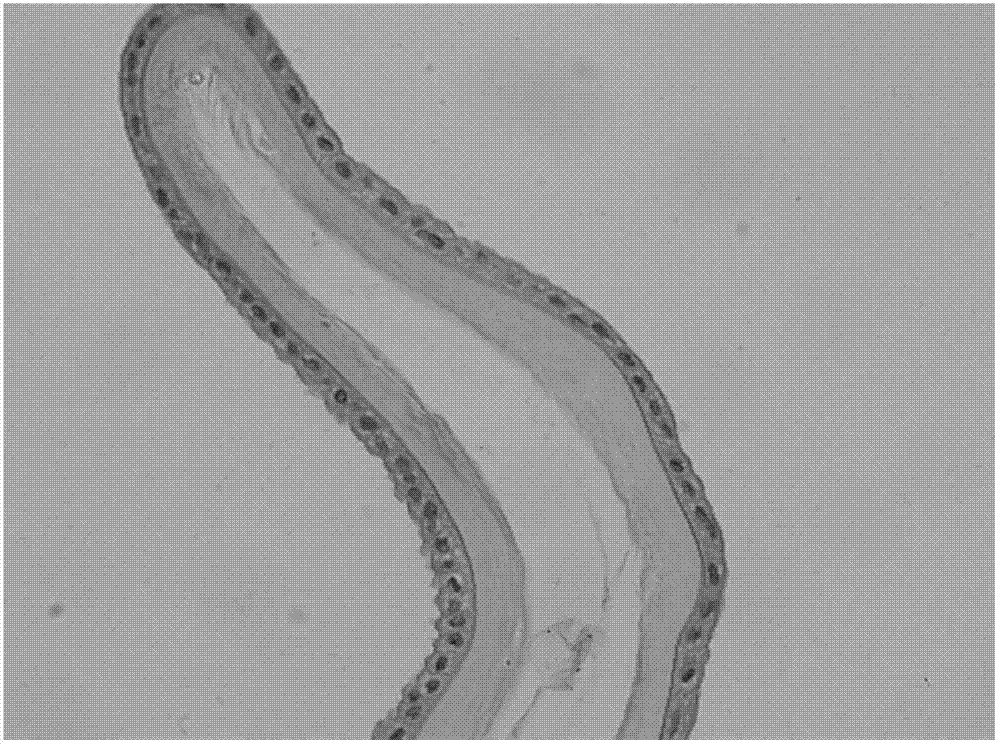 Composite anti-freezing liquid, and method for preserving human amnion by using same