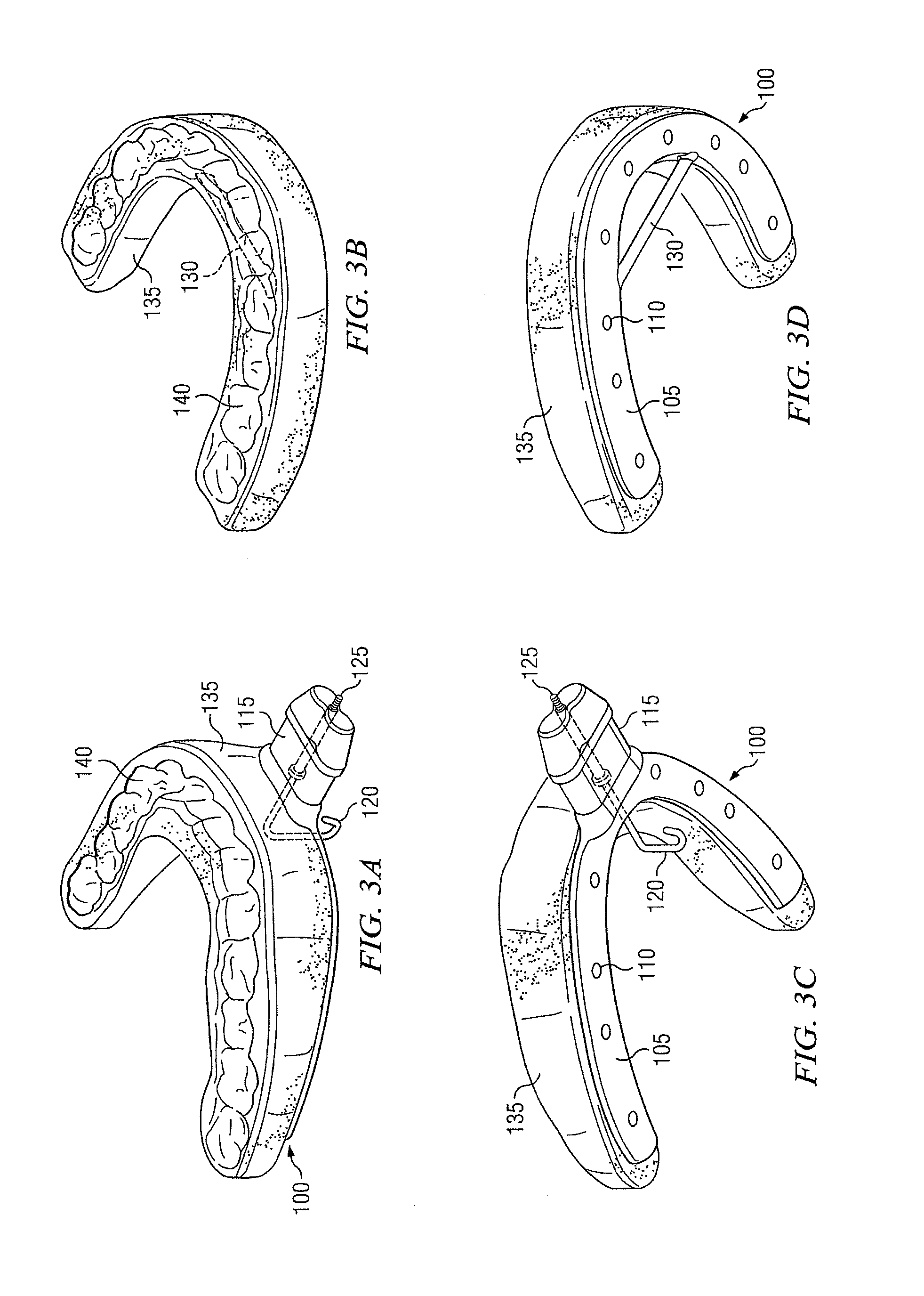 Universal oral appliance with a universal coupler