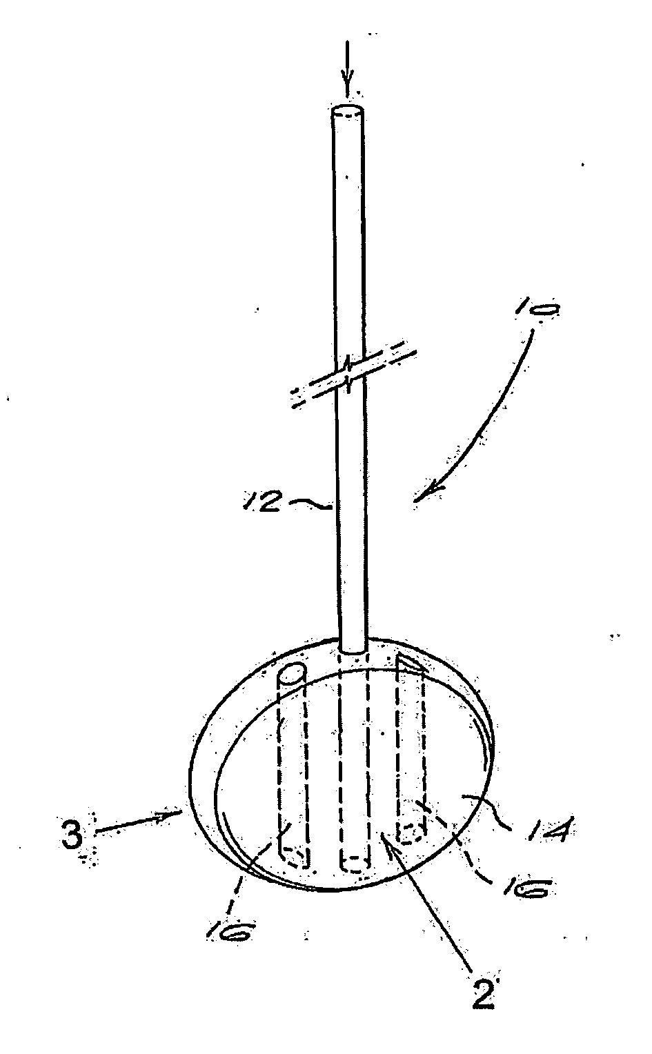 Spinal midline indicator