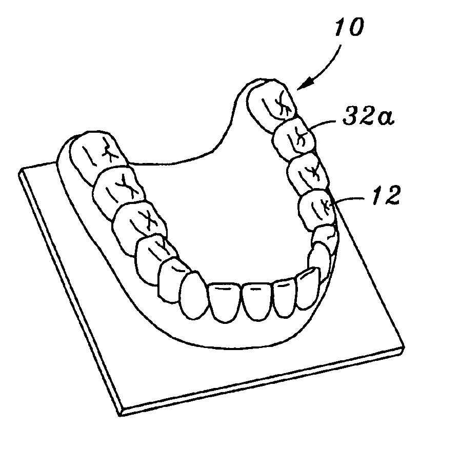 Dental prosthesis manufacturing process, dental prosthesis pattern & dental prosthesis made thereby