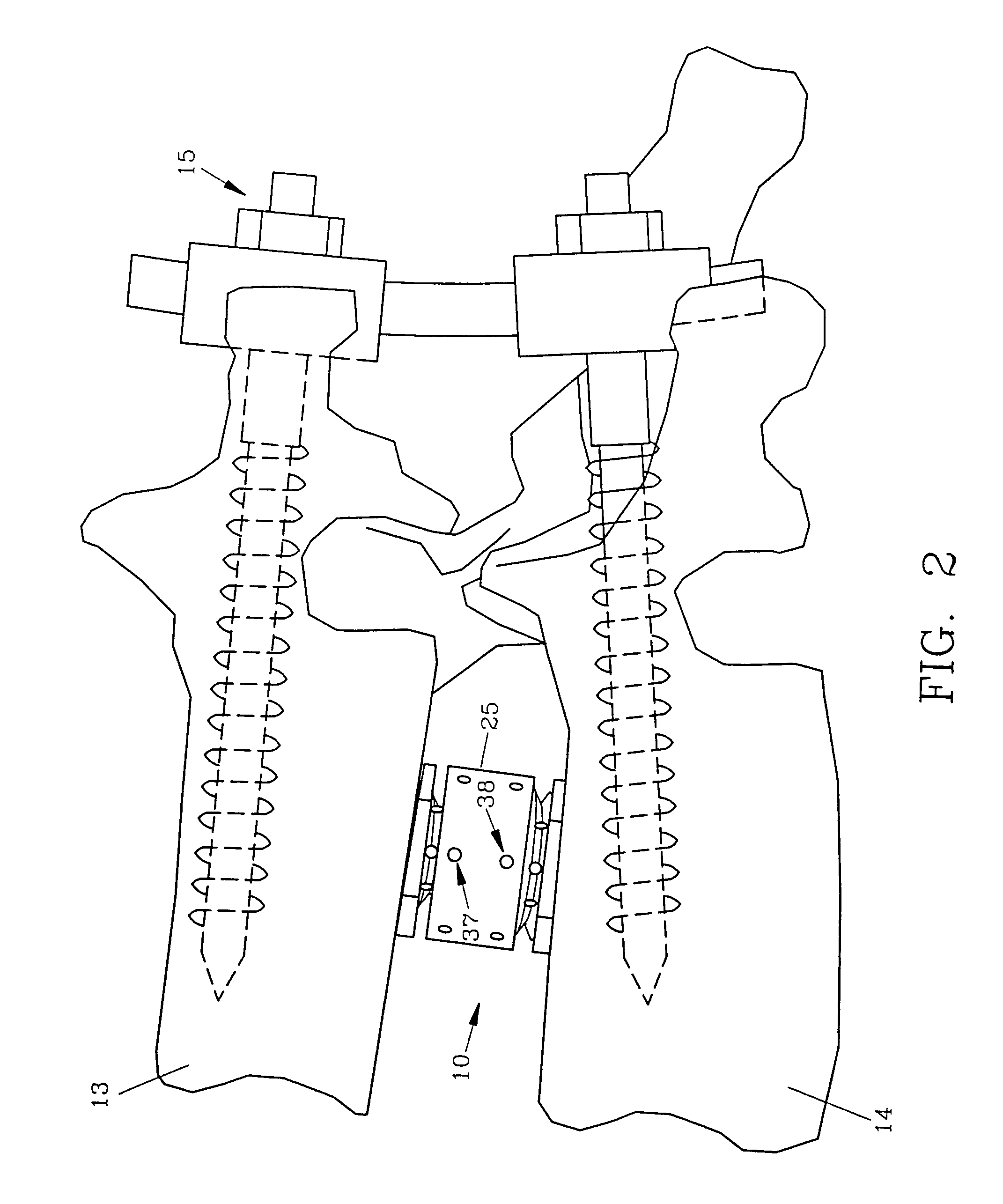 Spinal interbody fusion device and method