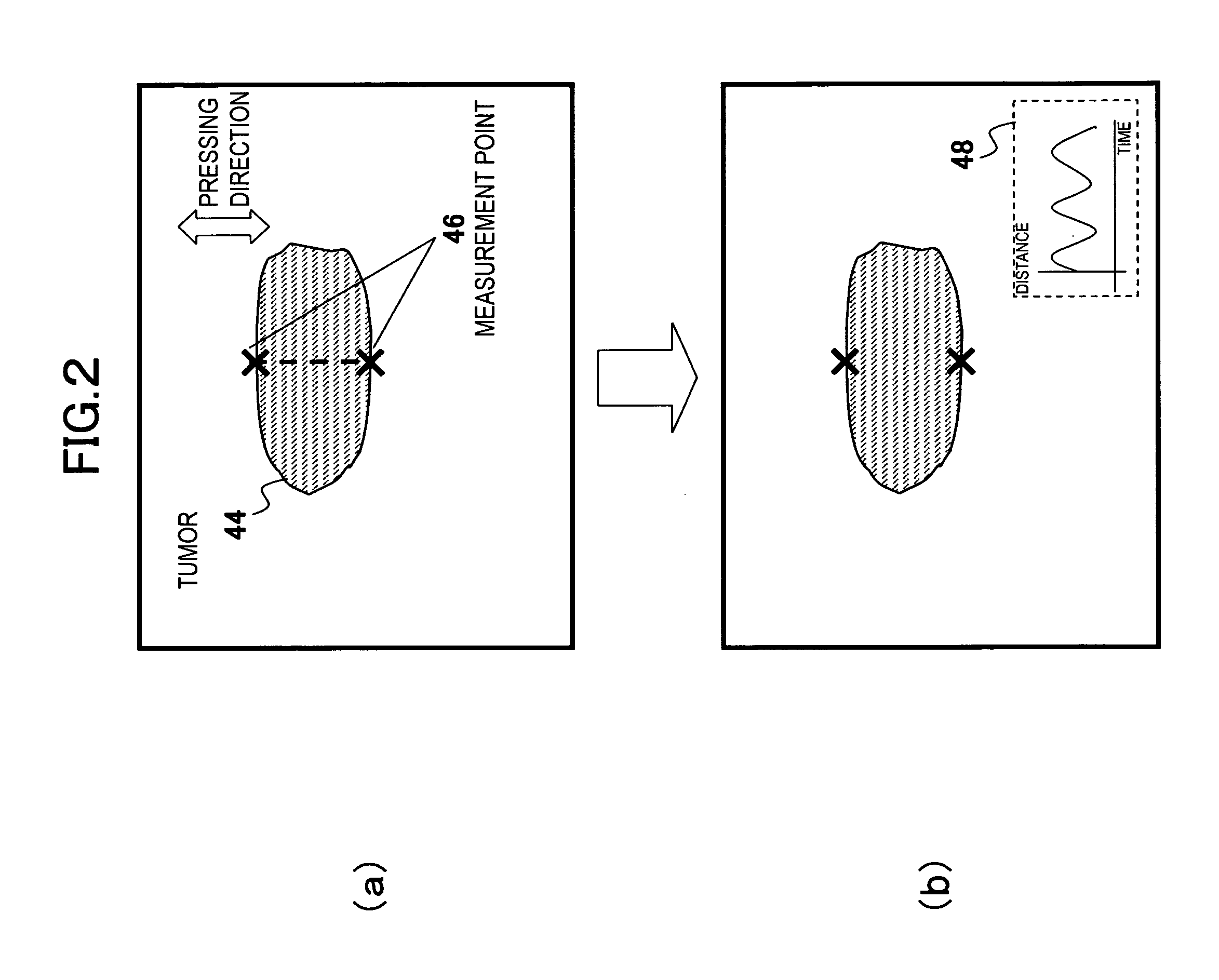 Ultrasonic diagnostic apparatus, ultrasonic image processing method, and ultrasonic image processing program