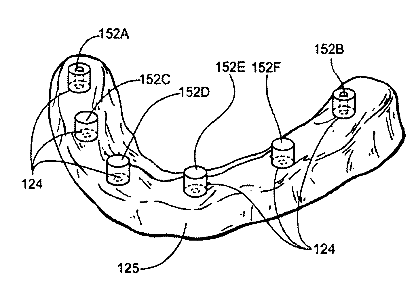 Method for Defining a Dental Framework Design Volume