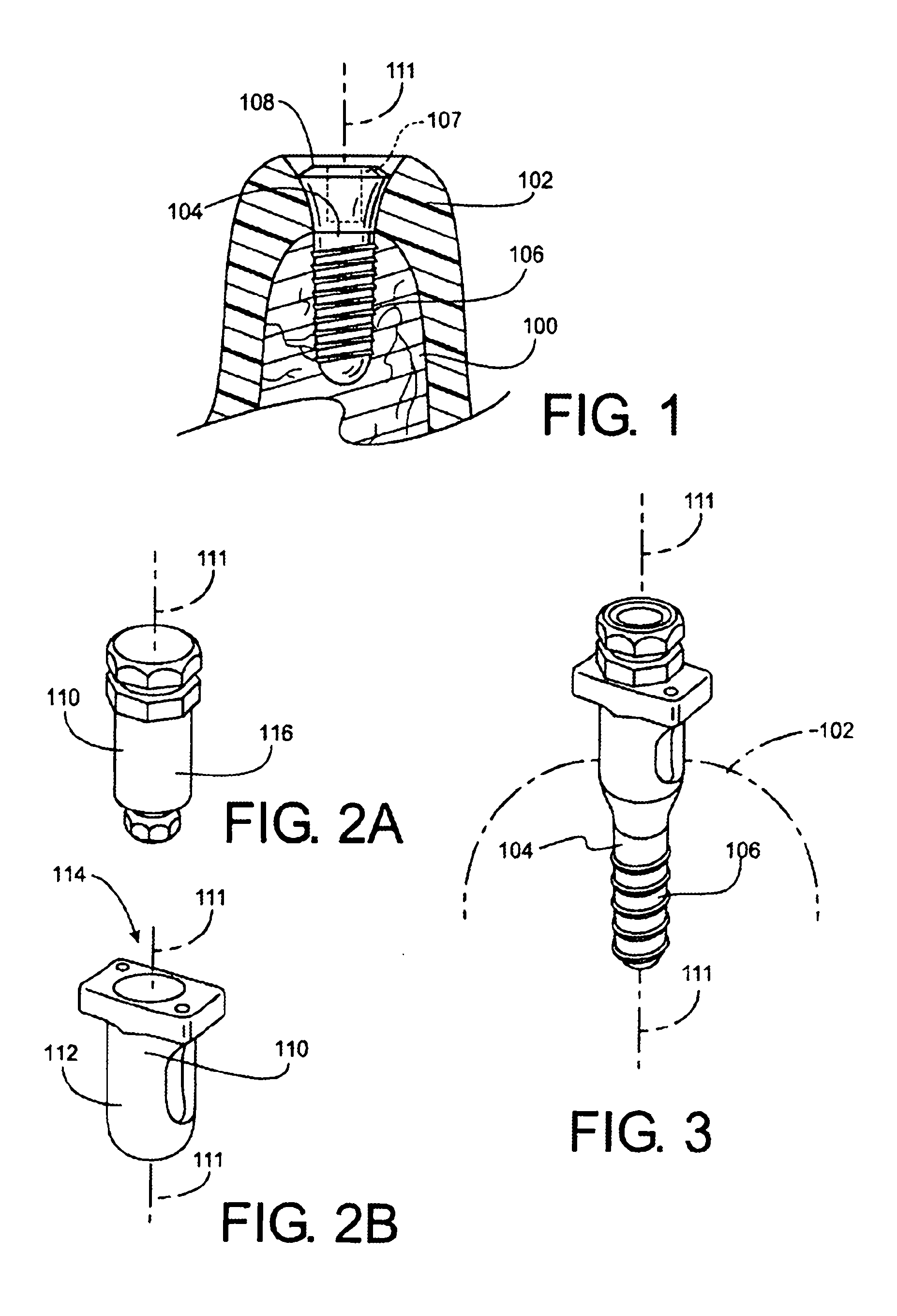 Method for Defining a Dental Framework Design Volume