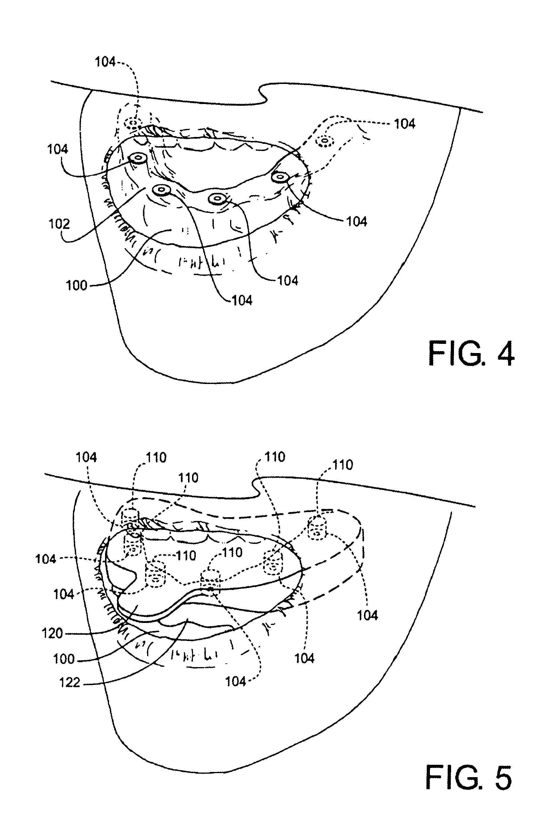 Method for Defining a Dental Framework Design Volume