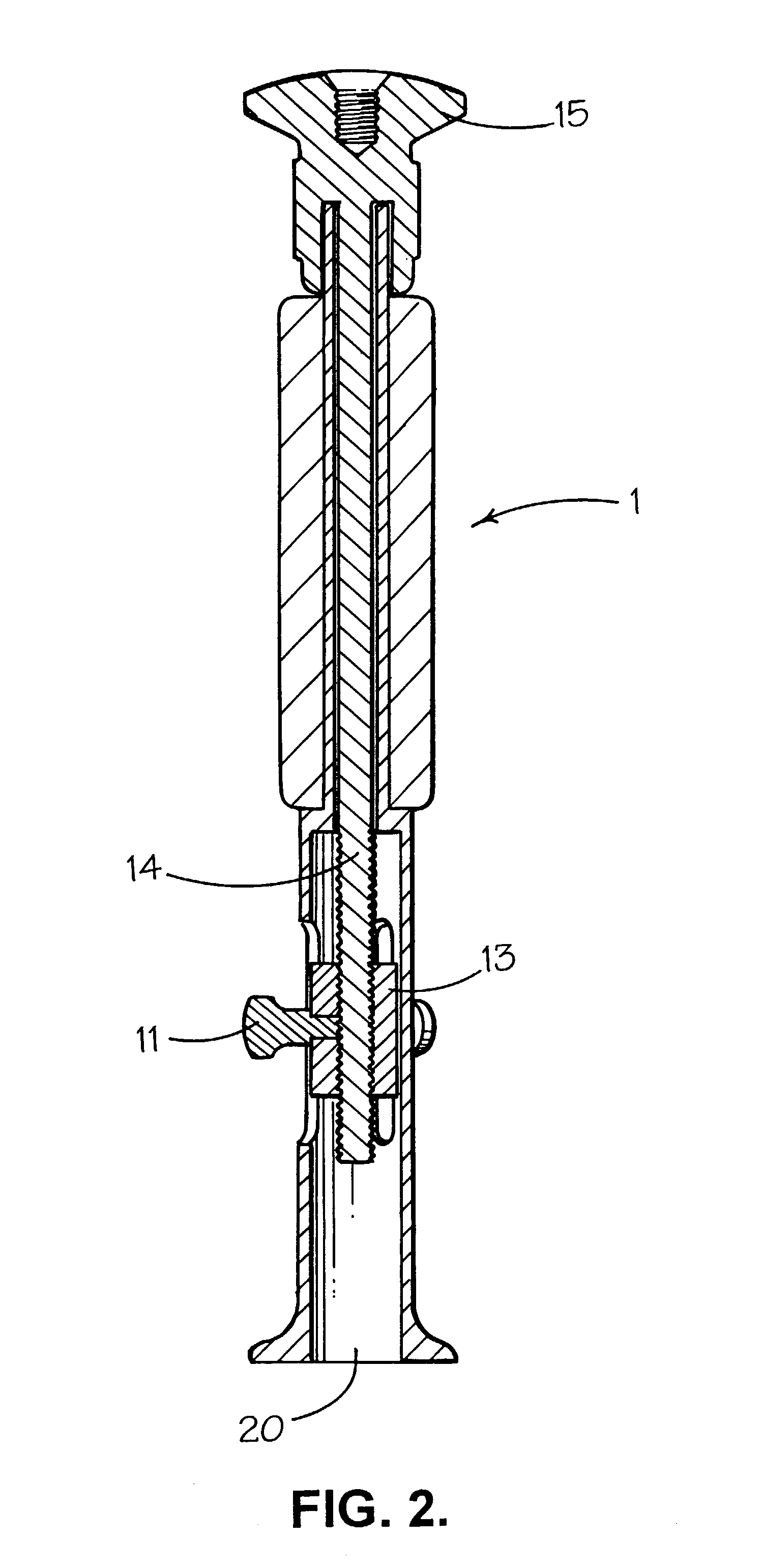 Prosthetic implant and surgical tool