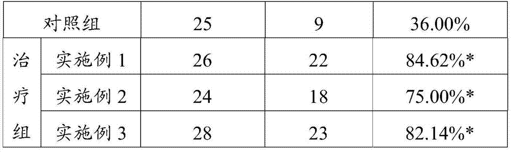 Chinese medicinal composition for treating common cold due to wind-cold and preparation method and application thereof