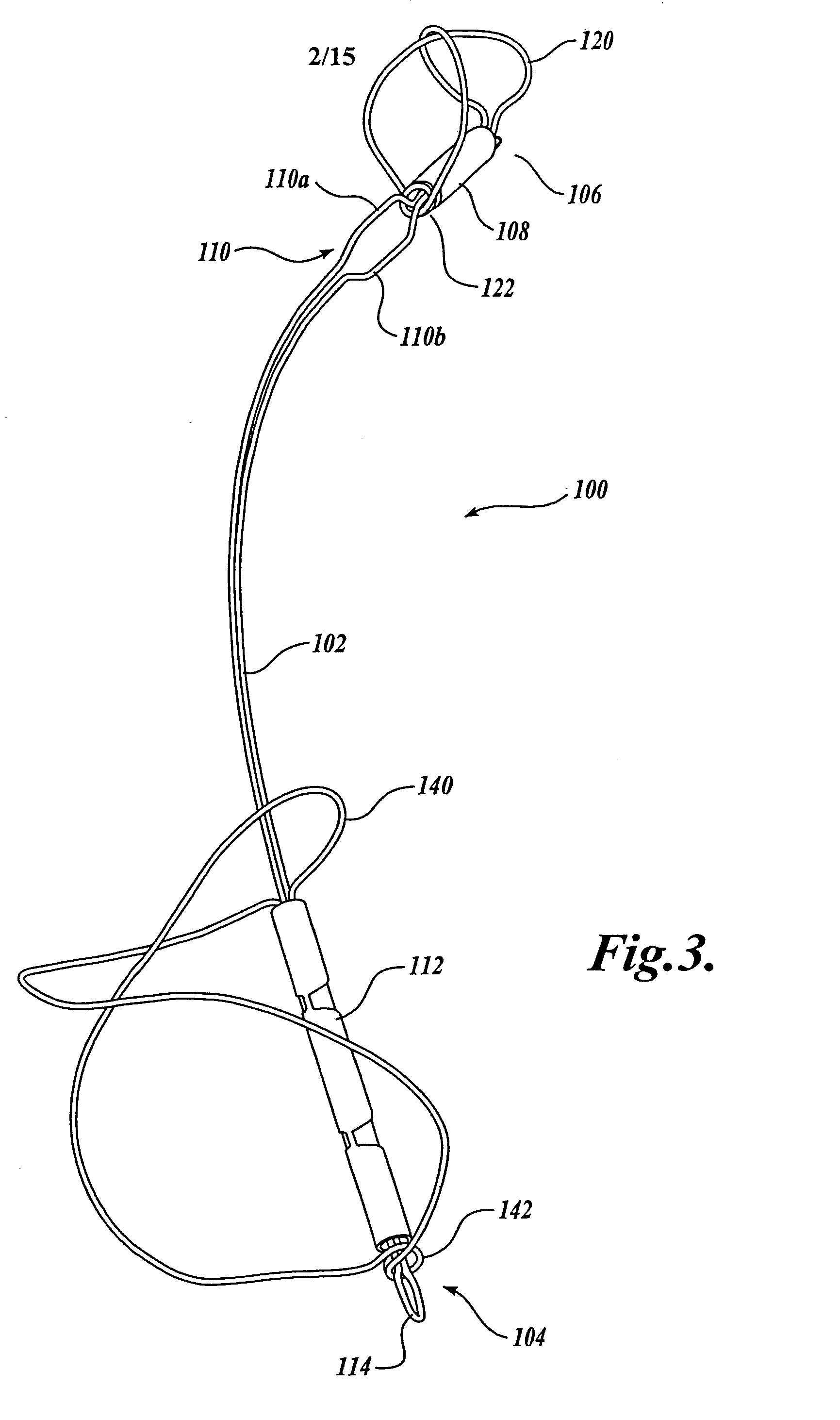 Device and method for modifying the shape of a body organ