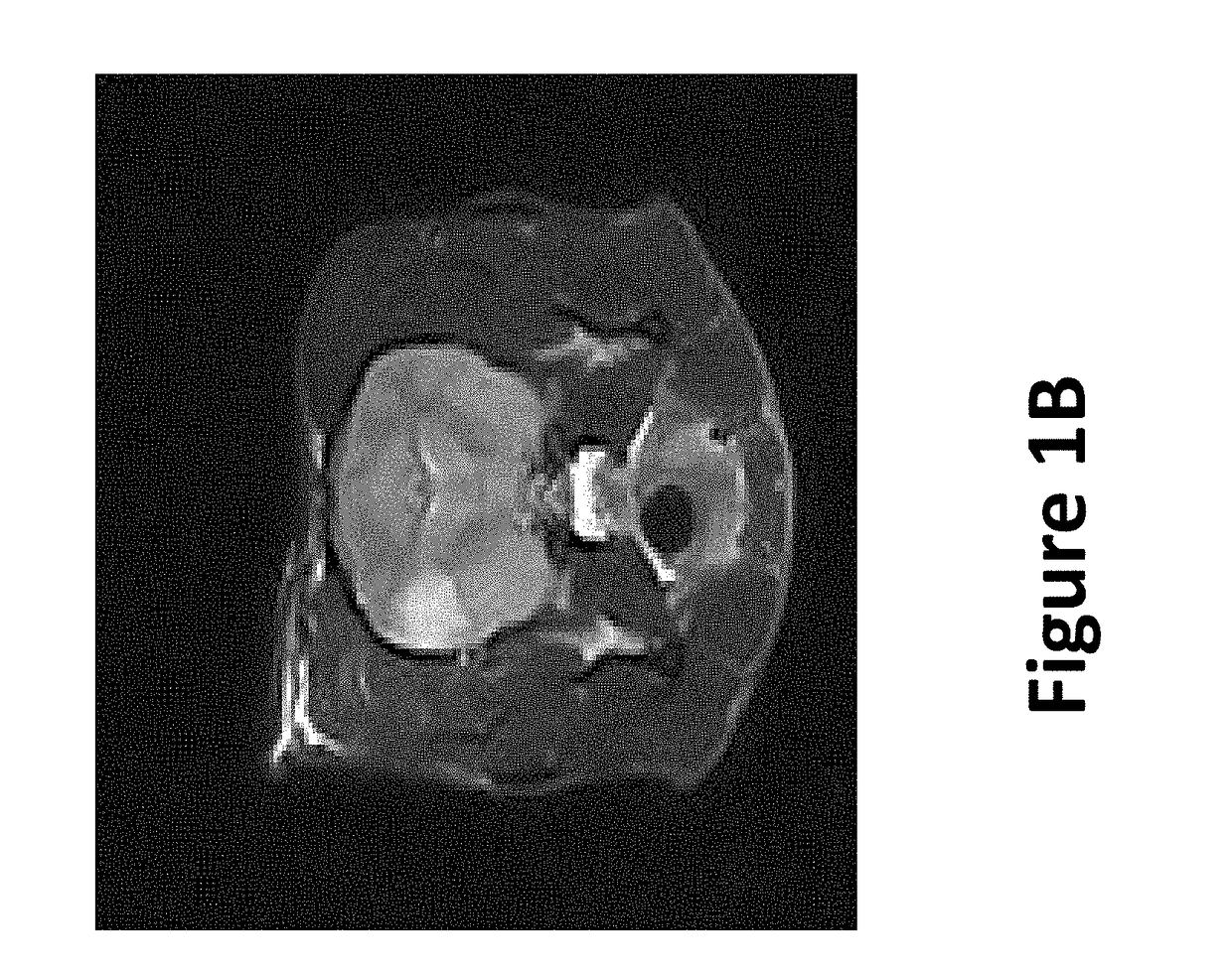 Irreversible electroporation to create tissue scaffolds