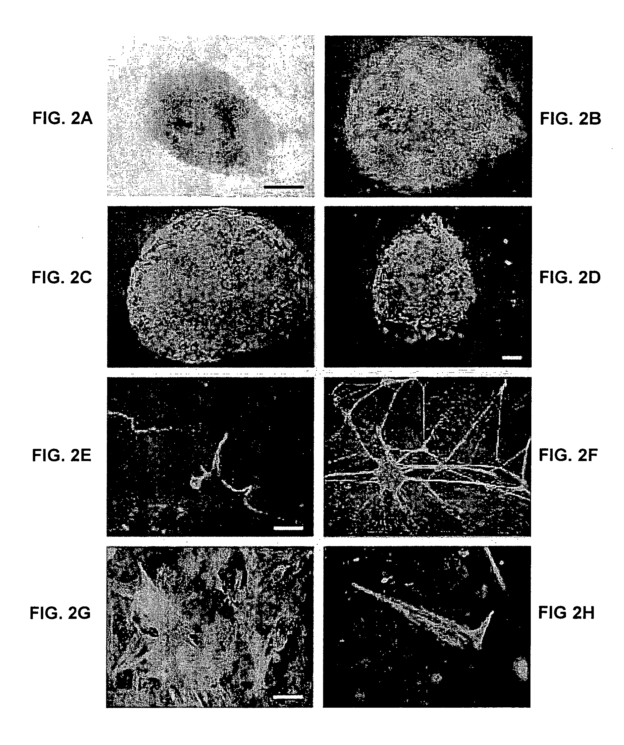 Embryonic stem cells and neural progenitor cells derived therefrom