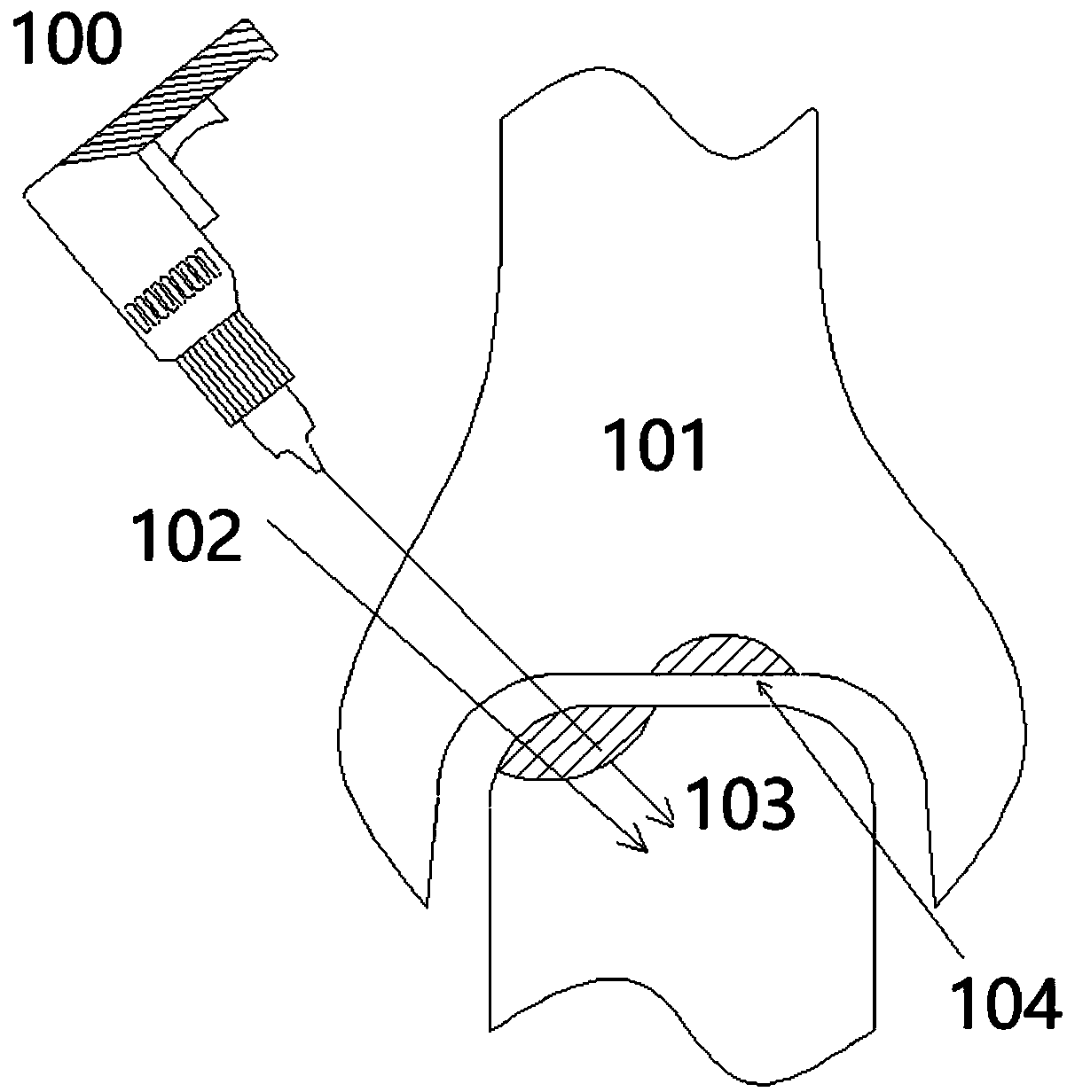 Astragalus drilling apparatus