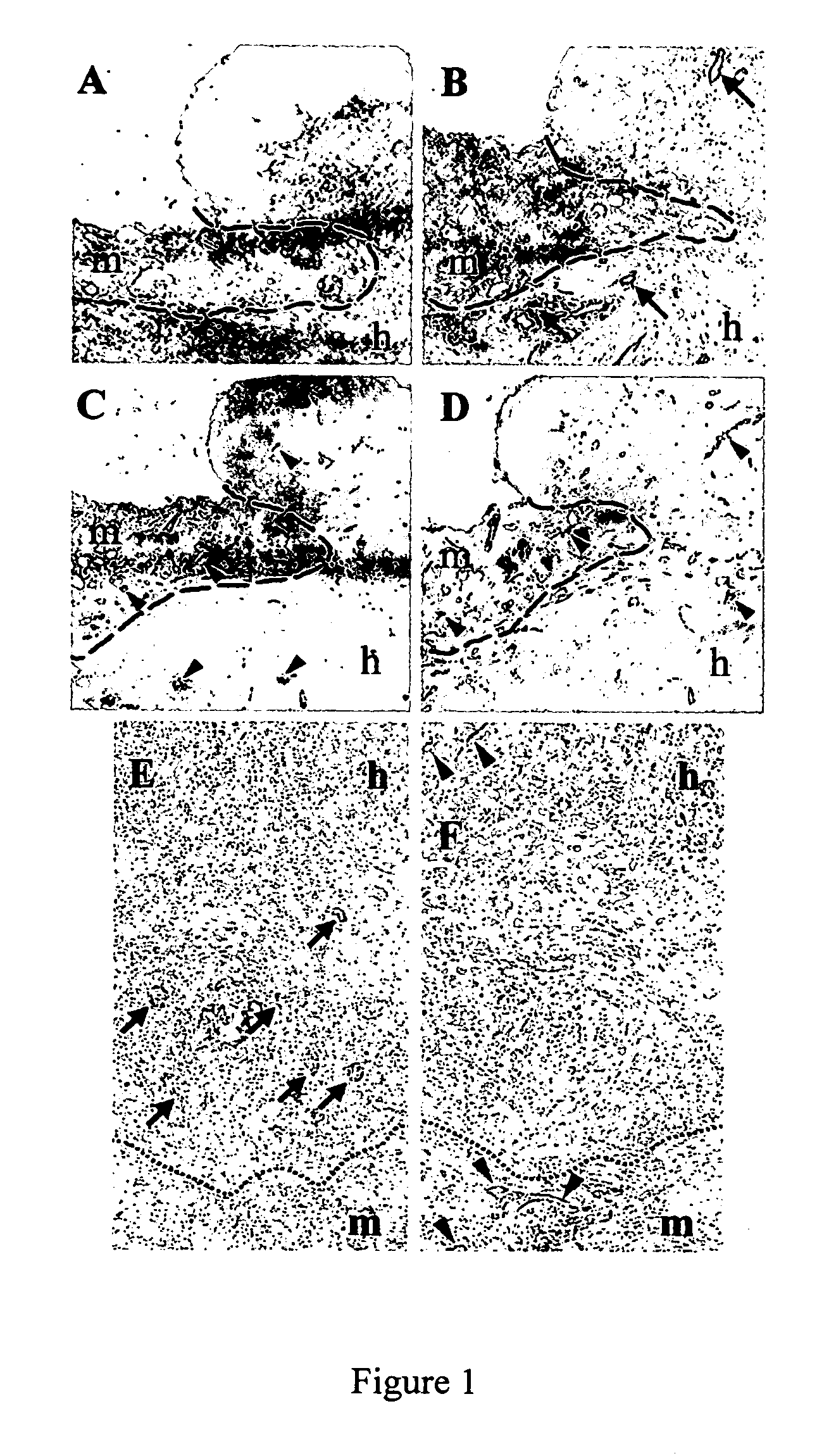 Method for increasing the efficacy of anti-tumor agents by anti-endoglin antibody