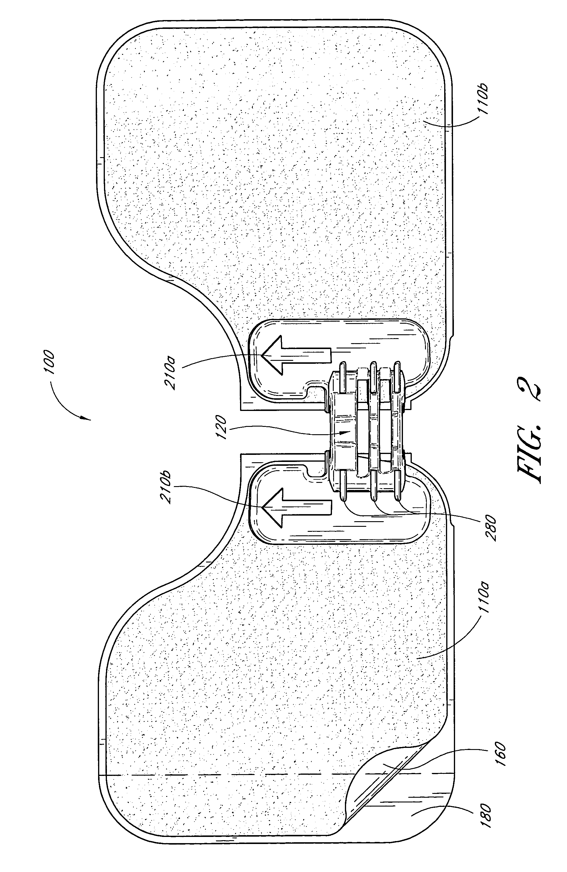 Catheter securement device