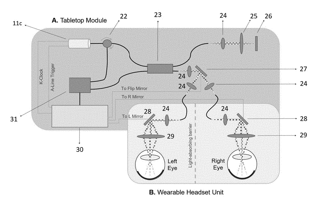 Brain monitoring system