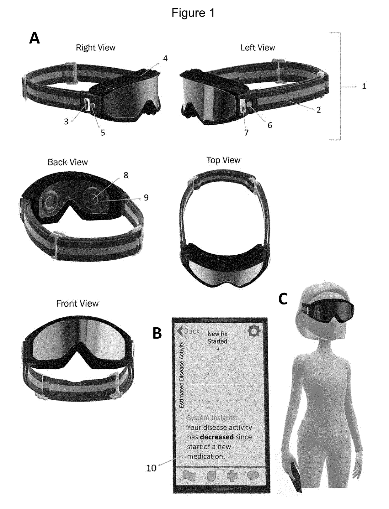 Brain monitoring system