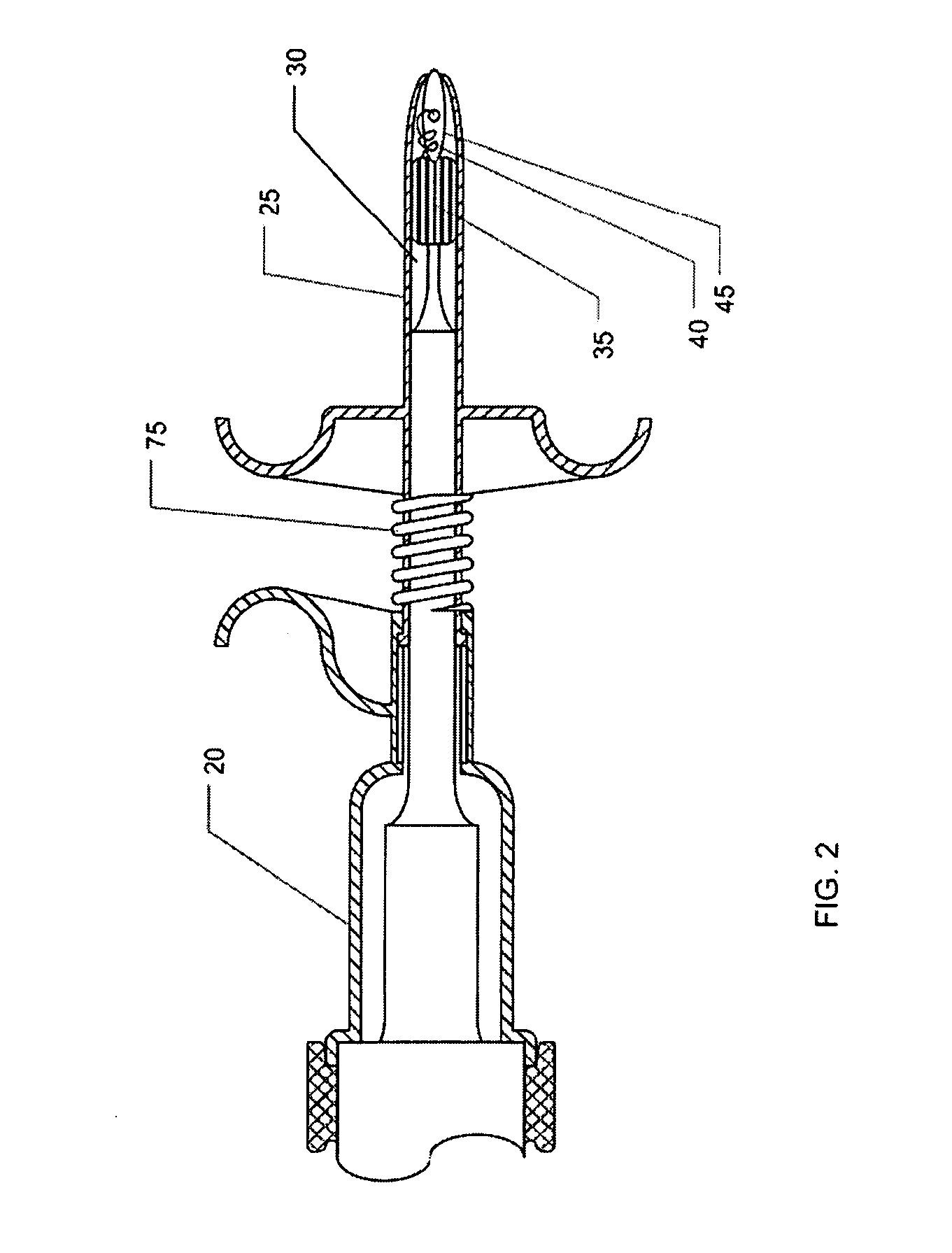 Ultrasonic vascular closure device