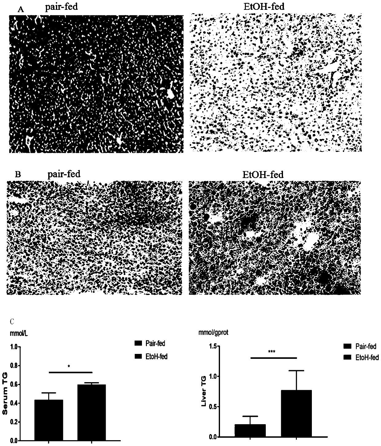 miR-451a antisense strand inhibitor and application thereof